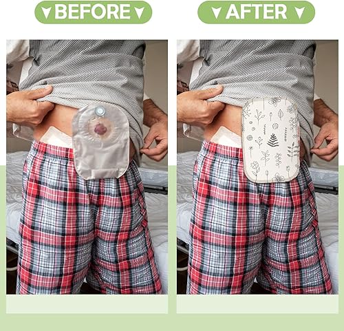 Miniatura 5 de 9 fundas para bolsas de ostomía, impermeables, para ducha, ligeras, para colostomía, reutilizables, lavables, con apertura ajustable, suministros de