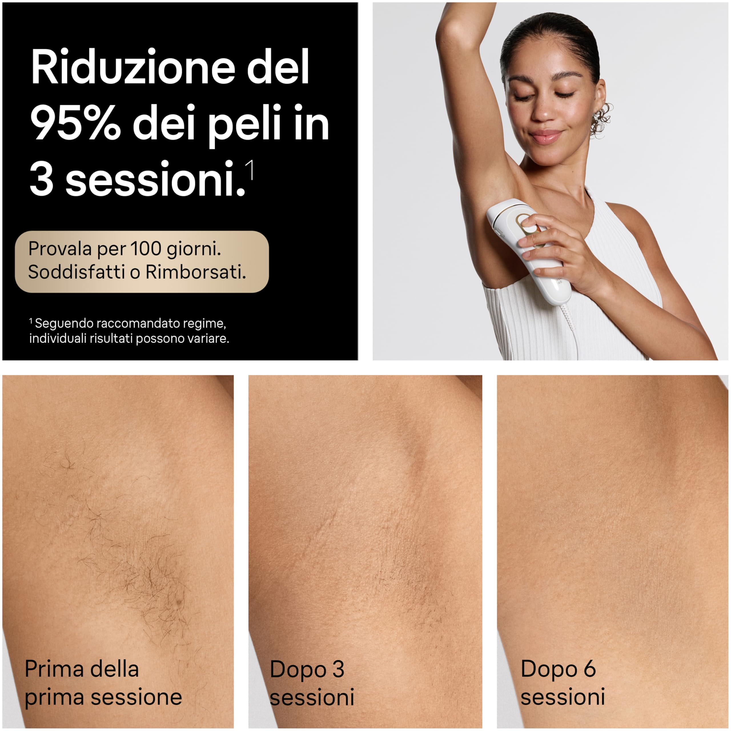 Braun Silk·Expert Pro 5, Epilatore Luce Pulsata Smart, Epilazione Laser Peli Donna a Casa, Riduzione Permanente dei Peli, con 3 Testine, Custodia e Rasoio Gillette Venus, Pl5321
