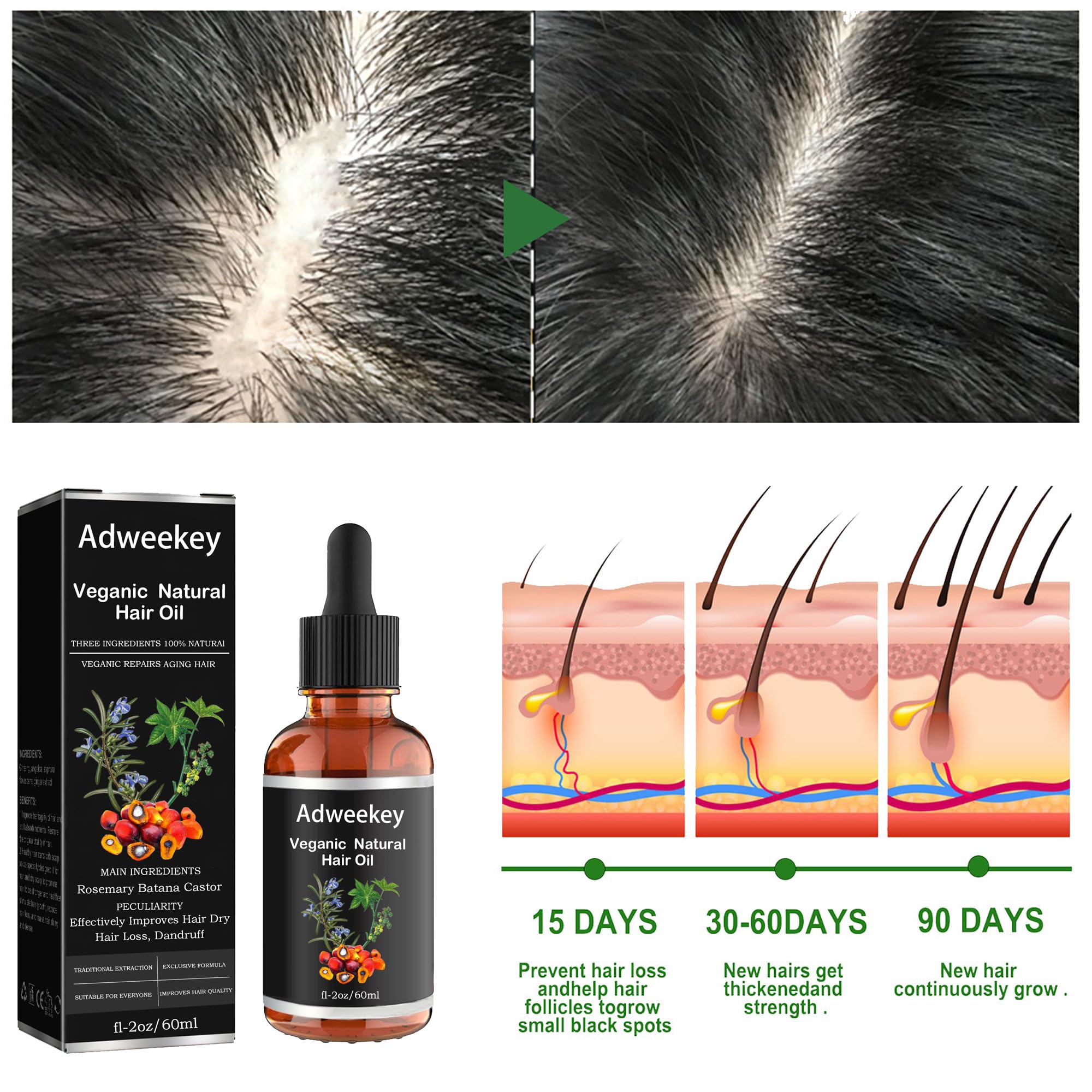 Amazon.com: Adweekey Aceite de ricino de romero de batana orgánico natural,  100% puro prensado en frío para un crecimiento saludable, mejora la  luminosidad del cabello para hombres y mujeres, 2 onzas líquidas :