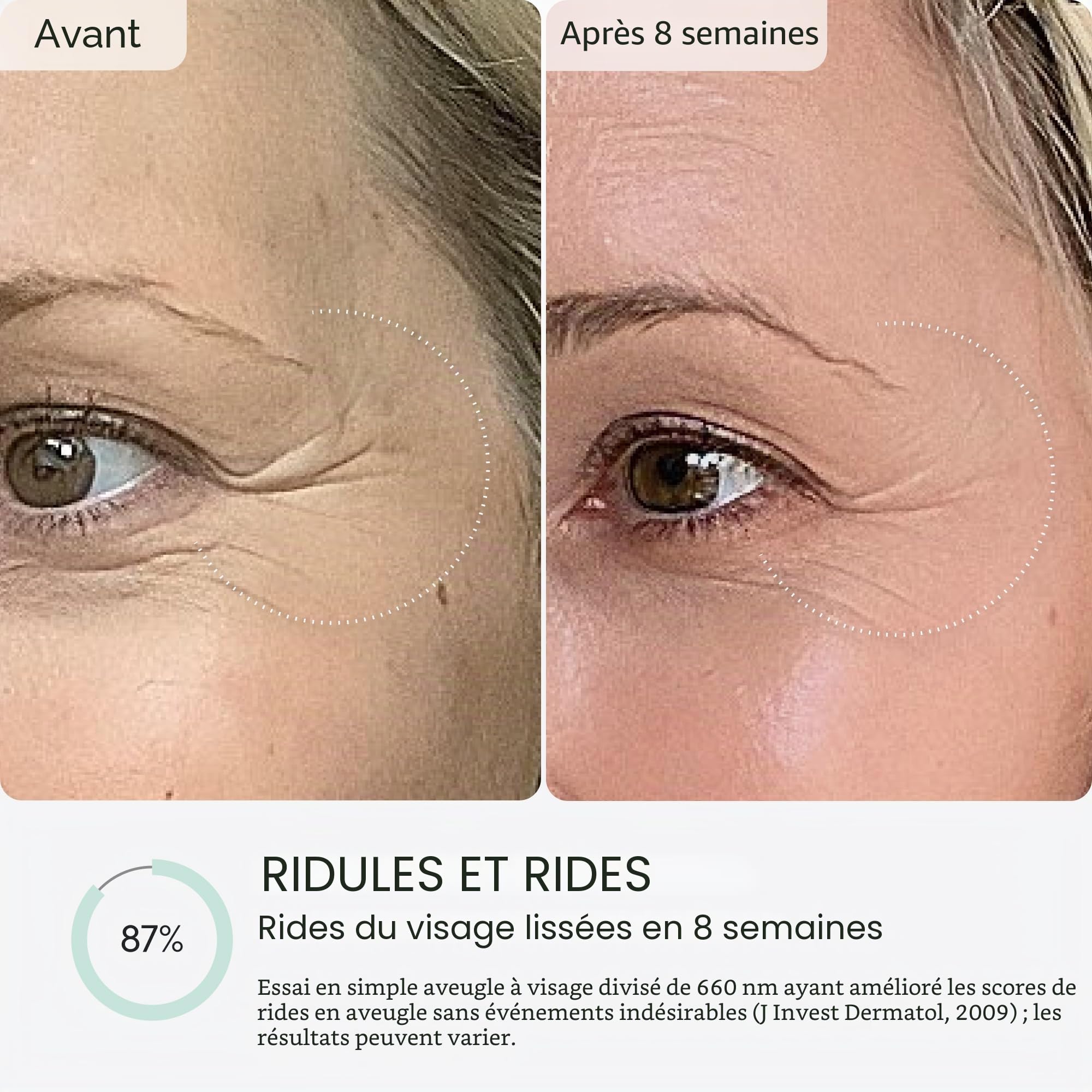 Qure Masque de soin de la peau LED avec 5 modes différents (thérapie par lumière rouge, lumière ambre et thérapie par lumière bleue) Un appareil avec paramètres et traitements personnalisables.