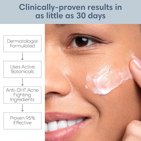 Clearogen Acne Lotion with Benzoyl Peroxide, Acne Cream, Face Moisturizer Acne Prone Skin, Acne Moisturizer for Face, 1.8 Fl oz