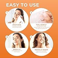 Vista 6 de Parches para acné (120 unidades), parches hidrocoloides para espinillas para la cara, parches para acné con puntos para acné quístico, parche