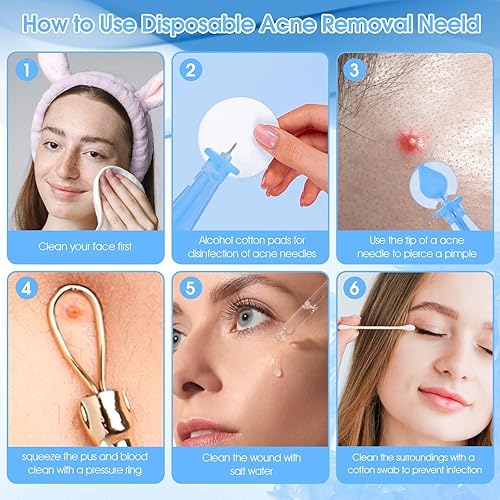 Miniatura 5 de 100 unidades desechables para eliminar manchas de puntos negros, agujas estériles para espinillas, herramienta para acné, puntos blancos, boca