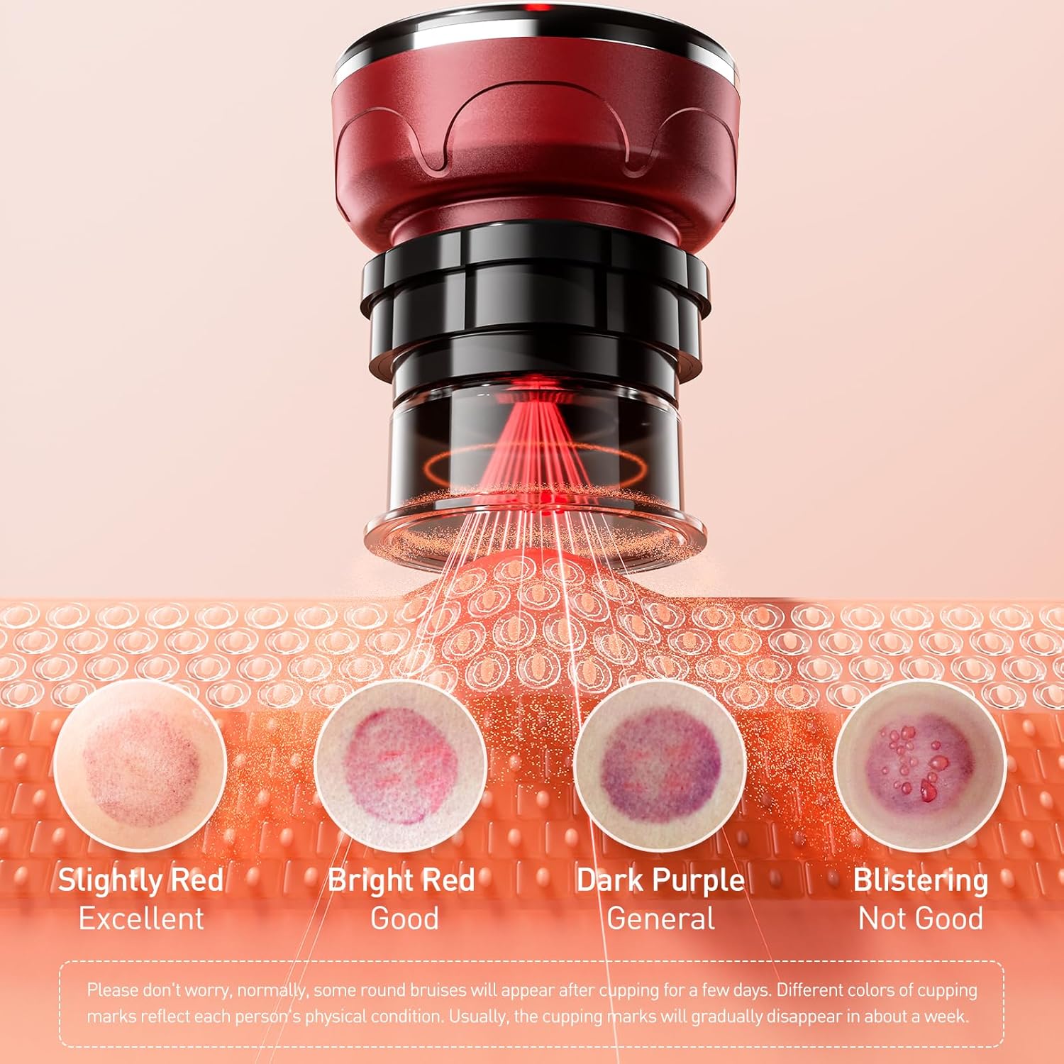 UBALANCE Cupping Kit for Massage Therapy, Cupping Therapy Set 6 Cups, Electric Smart Cupping Machine, 4 in 1 Negative Pressure Massager with 12 Modes for Fatigue Relief, Red - Image 5