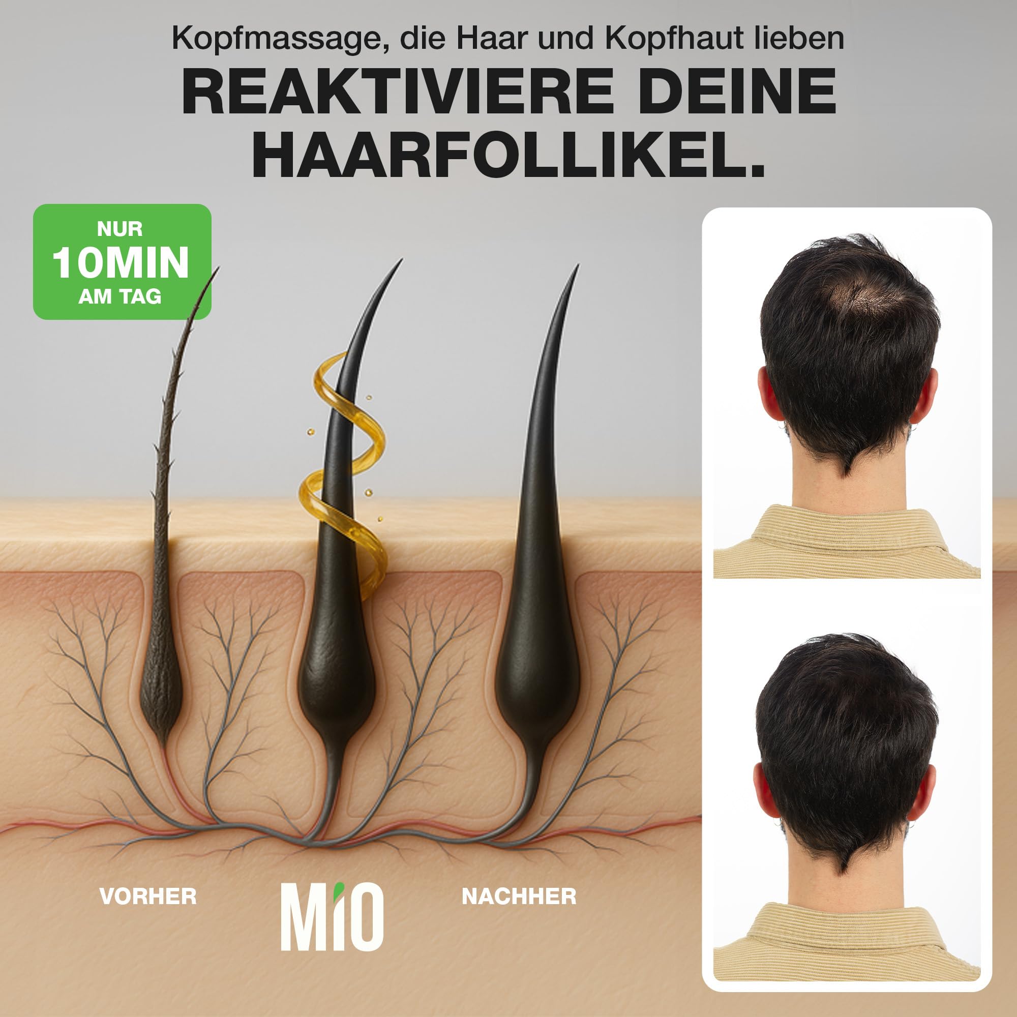 DONNERBERG® MIO Kopfmassagebürste mit Rotlicht gegen Haarausfall, Kabellos