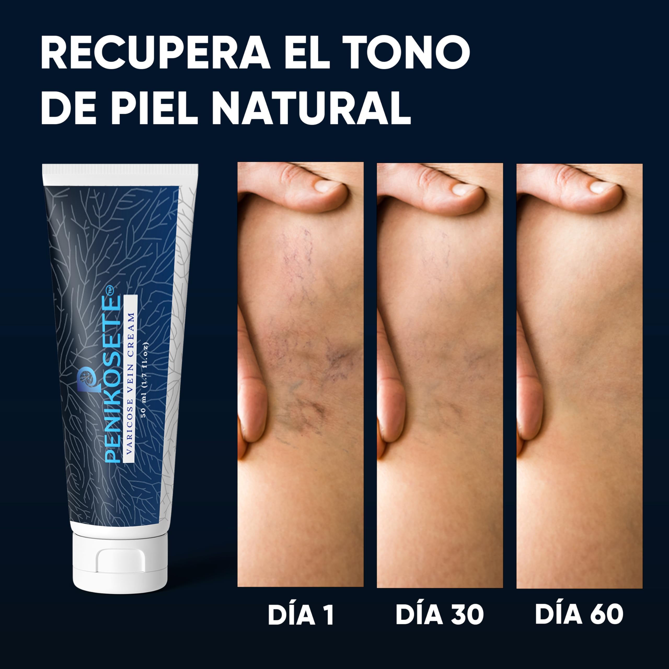PENIKOSETE Crema Varices y Arañas Vasculares | Fórmula Ayurvédica Ashwagandha | Alivia Pesadez, Hinchazón y Calambres | Mejora Circulación Venosa | Natural, No Pegajosa | Certificada AYUSH