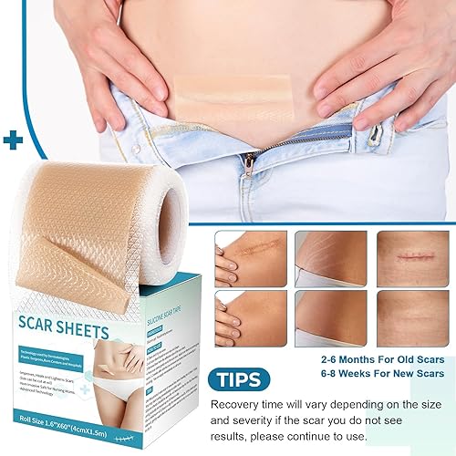 Miniatura 5 de Hojas de silicona para cicatrices, cinta de silicona para cicatrices (rollo de 1.6 x 60 pulgadas, 4.9 ft), tiras de cicatrices de silicona, hojas
