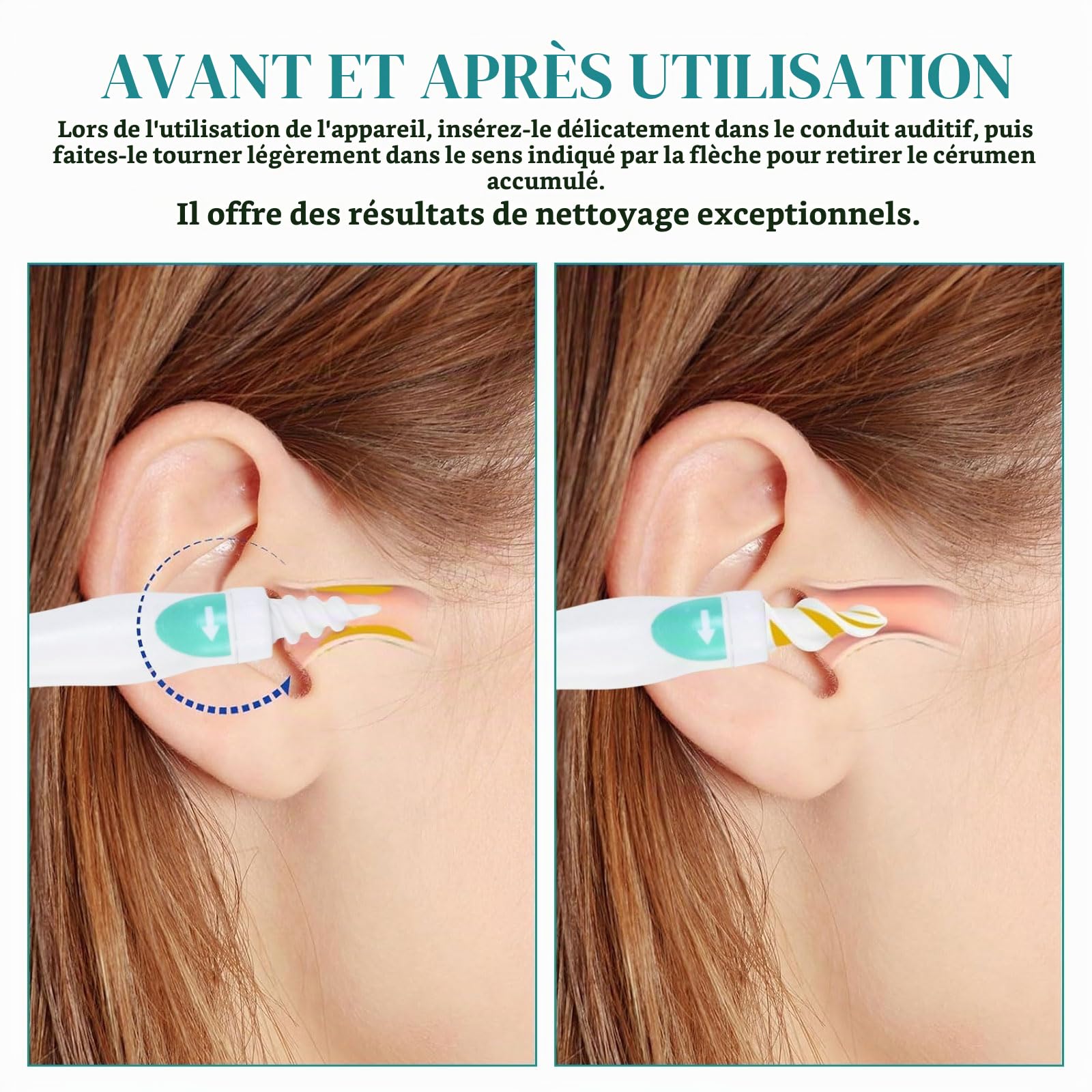 Nettoyeur Oreille Spirale 360° en Silicone, Nettoyant Doux avec 3 Types de Têtes, Kit Auriculaire pour Adultes et Enfants, 16 Embouts Lavables