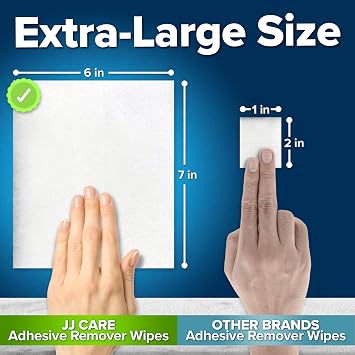 Adhesive Remover Wipes [Pack of 50] - Large Stoma Wipes - Sting Free Adhesive Remover for Skin Ostomy, Stoma, Colostomy Devices and Dressings