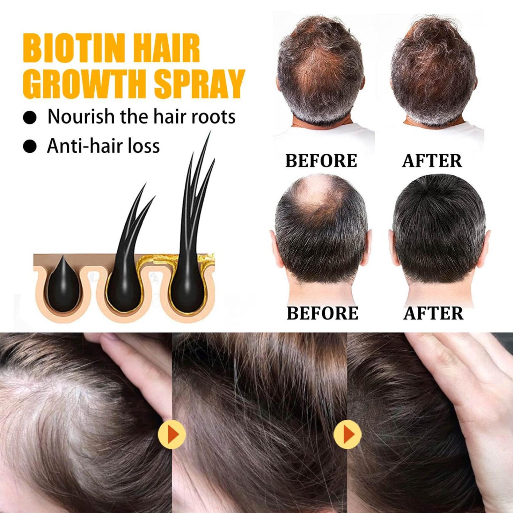 Biotin Rosemary Oil Spray For Hair Growth. Vegan Leave In Conditioner For Women, Men. Strengthens & Hydrates Thinning, Dry Hair For A Healthier-Looking Scalp
