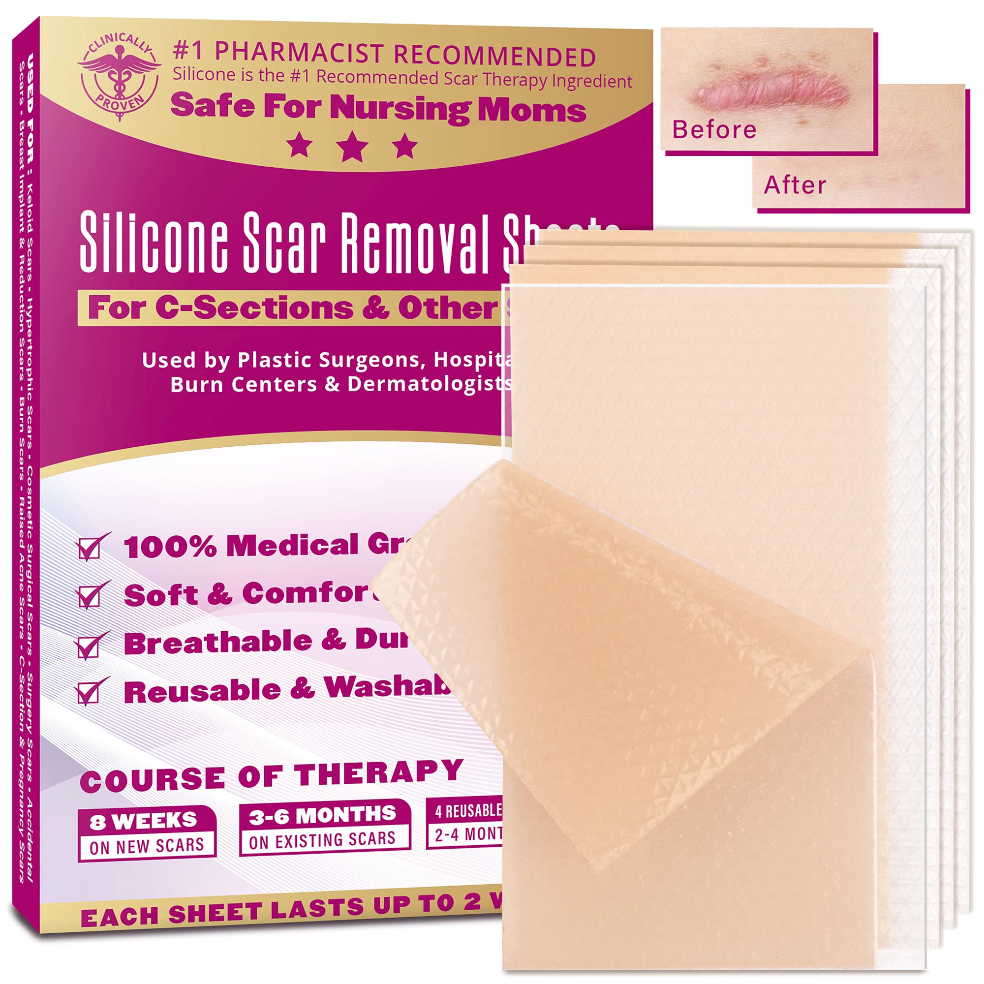 Buy MedicalGrade removal sheet, Clinically Proven, Silicone sheets for