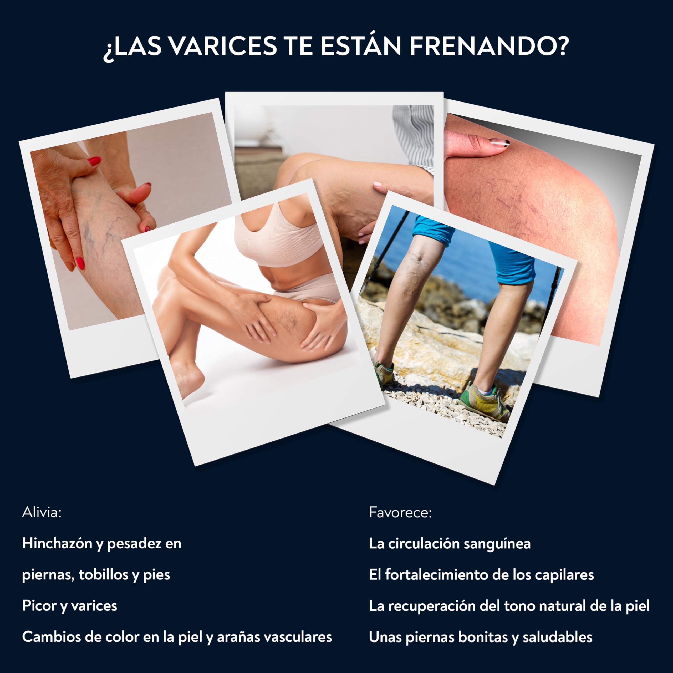 PENIKOSETE Crema Varices y Arañas Vasculares | Fórmula Ayurvédica Ashwagandha | Alivia Pesadez, Hinchazón y Calambres | Mejora Circulación Venosa | Natural, No Pegajosa | Certificada AYUSH
