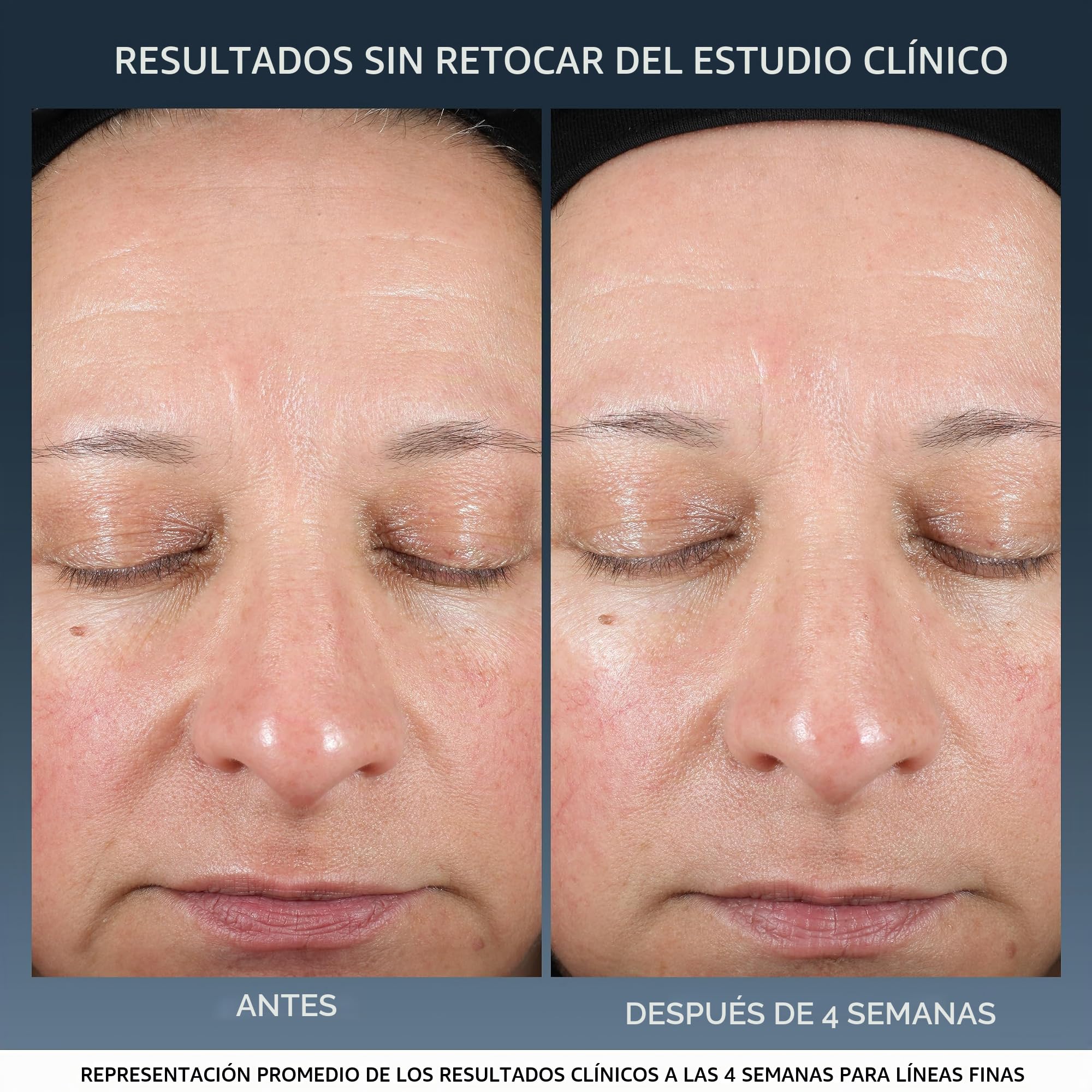 Lancôme - Advanced Génifique - Crema de Noche Reparadora - Hidratante y Antiedad - Tratamiento Facial Antiarrugas - Pre y Probióticos, Triple Ceramidas, Ácido Hialurónico - 50 ml