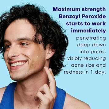 CLEAN & CLEAR Persa-Gel 10 Maximum Strength 1 oz (Pack of 5)