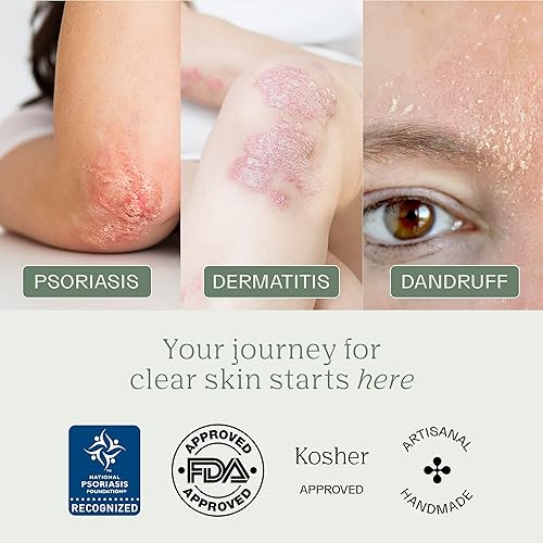 Miniatura 8 de Dermabon Paquete de barra de jabón de crema para dermatitis seborreica y psoriasis Extracto de caléndula, ácido salicílico y crema de cera de abeja