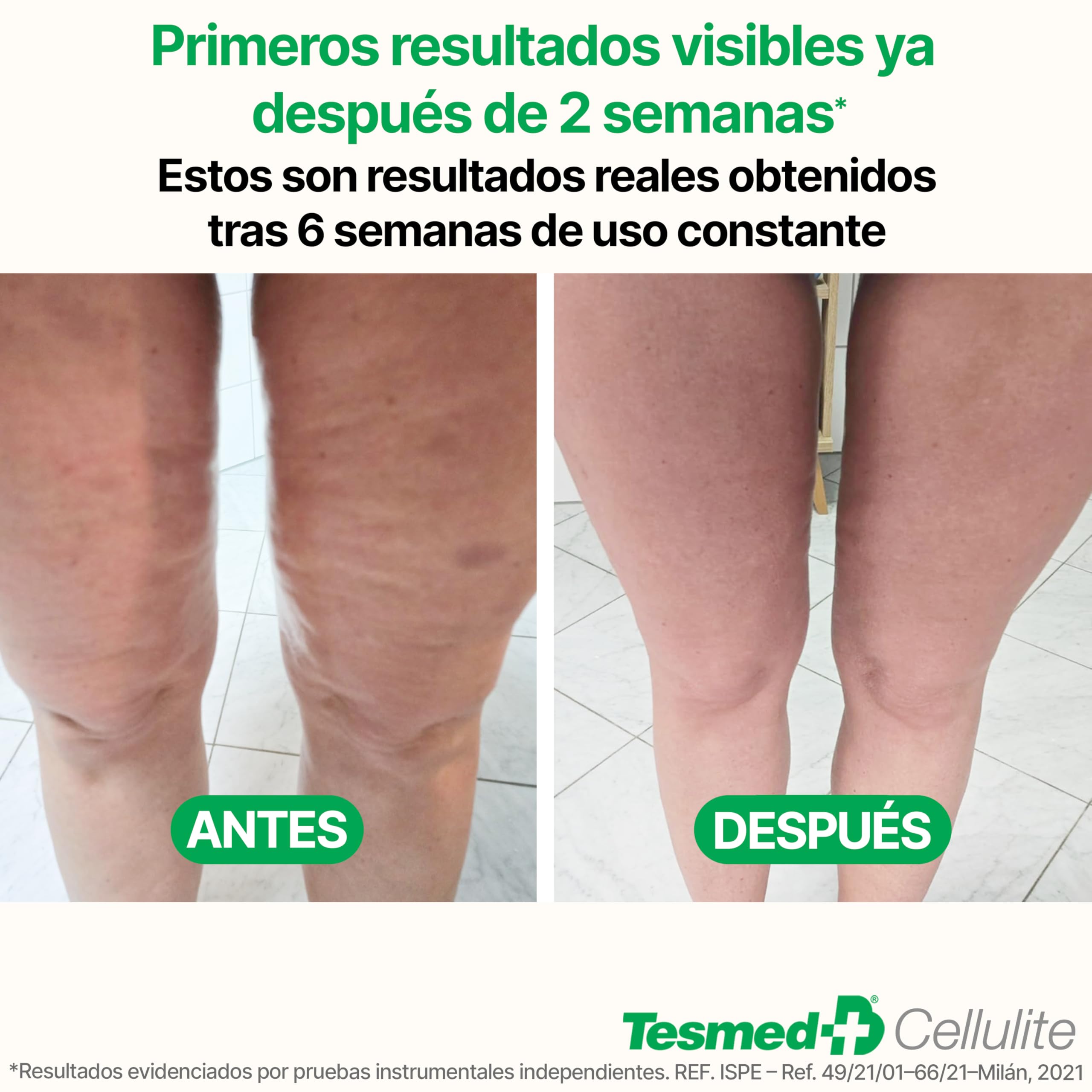 TESMED Masajeador Anticelulítico Reductor Rodillo Anticelulítico Reafirmante Patentado Fabricado en Italia