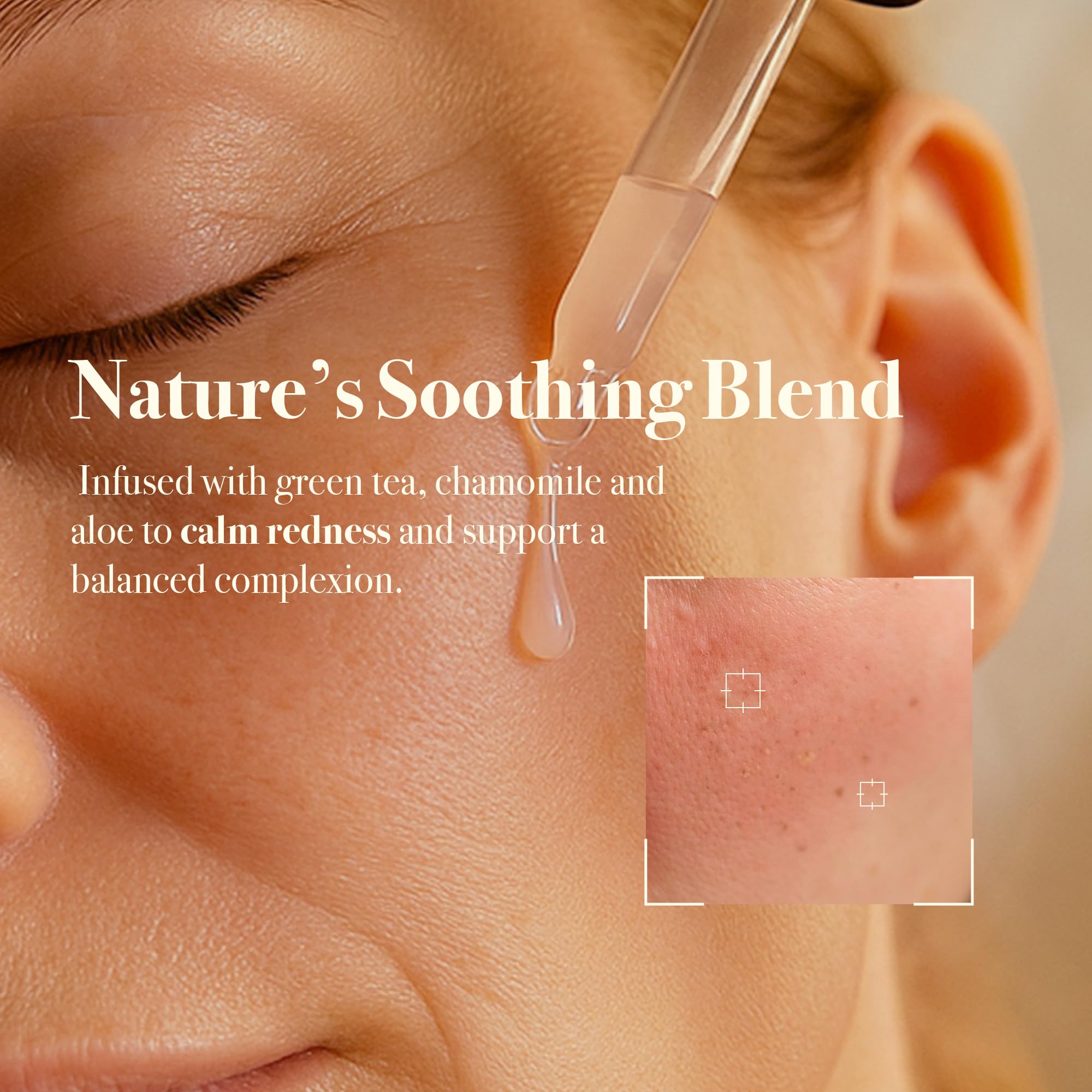 Napiers Anti-Blemish Serum - Niacinamide, Zinc PCA & Salicylic Acid - Clarifies Blemish-Prone Skin, Reduces Redness & Breakouts - 30ml - Image 3