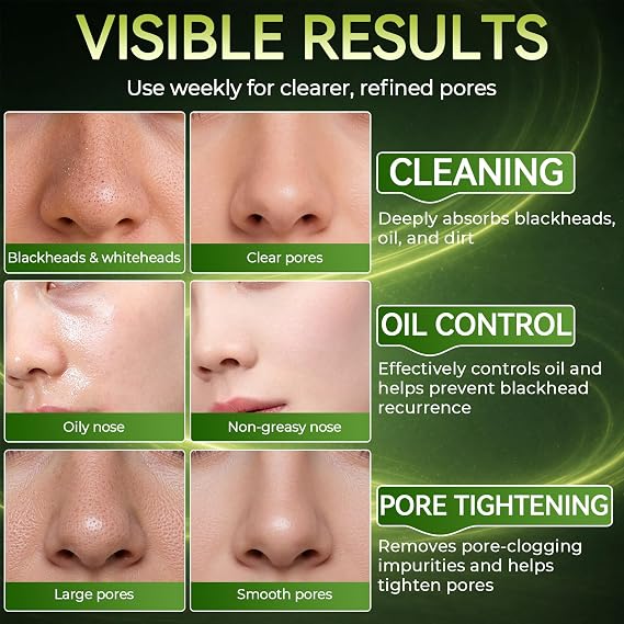Blackhead Remover Strips, 10 PCS Charcoal Pore Strips, Nose Strips Blackhead Remover, Blackhead Strips for Deep Cleansing, Keep Skin Clear and Tighten Pores, for All Skin Types, Individually Wrapped