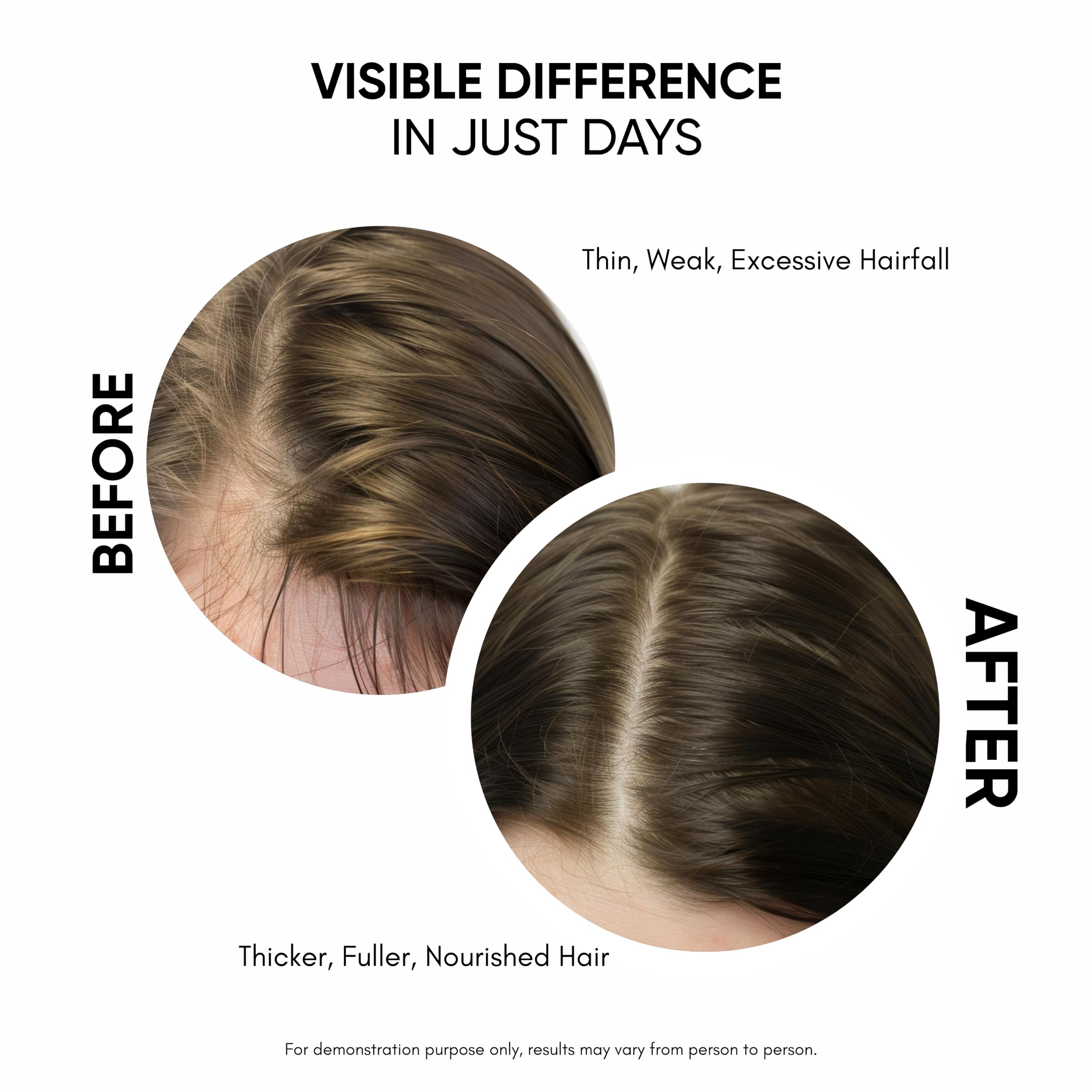 Masofta Hair Growth Serum with Redensyl, Capixyl, Anagain, Procapil and Rosemary