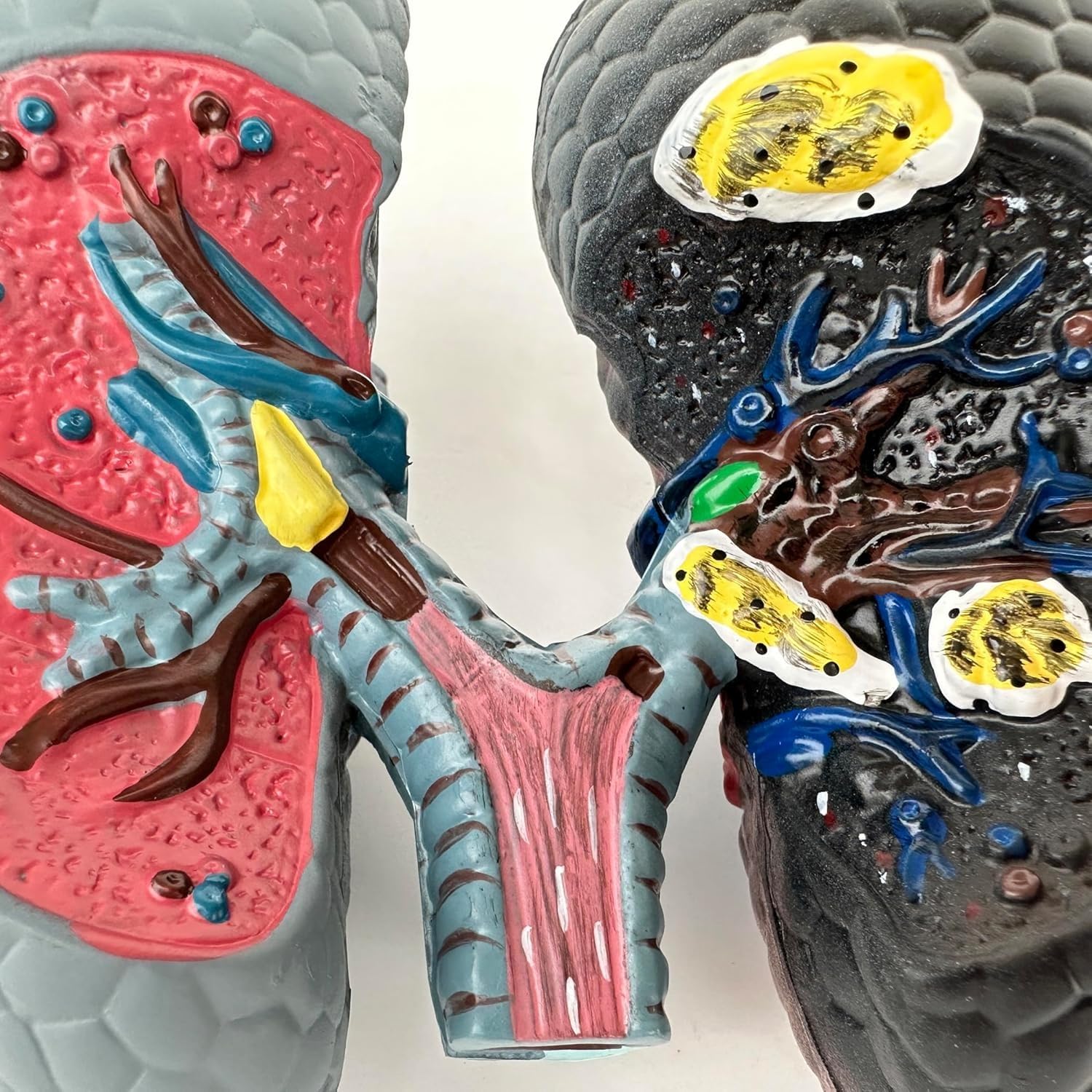 Model porównawczy palenia i zdrowych płuc, model anatomiczny dróg oddechowych i oskrzeli do nauczania, narzędzie do wyświetlania nauczania medycznego