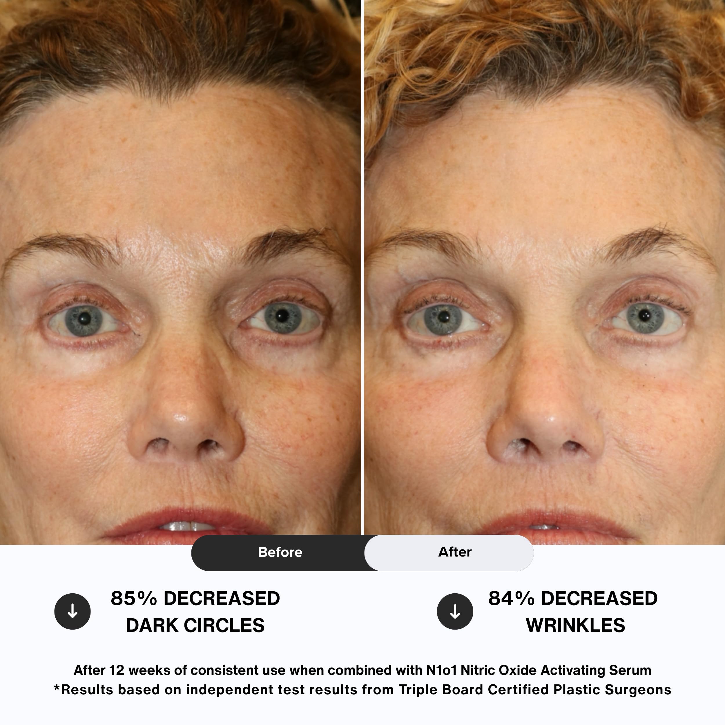 N1O1 Age-Defiance Eye Cream with Peptides, Hyaluronic Acid & Ceramides