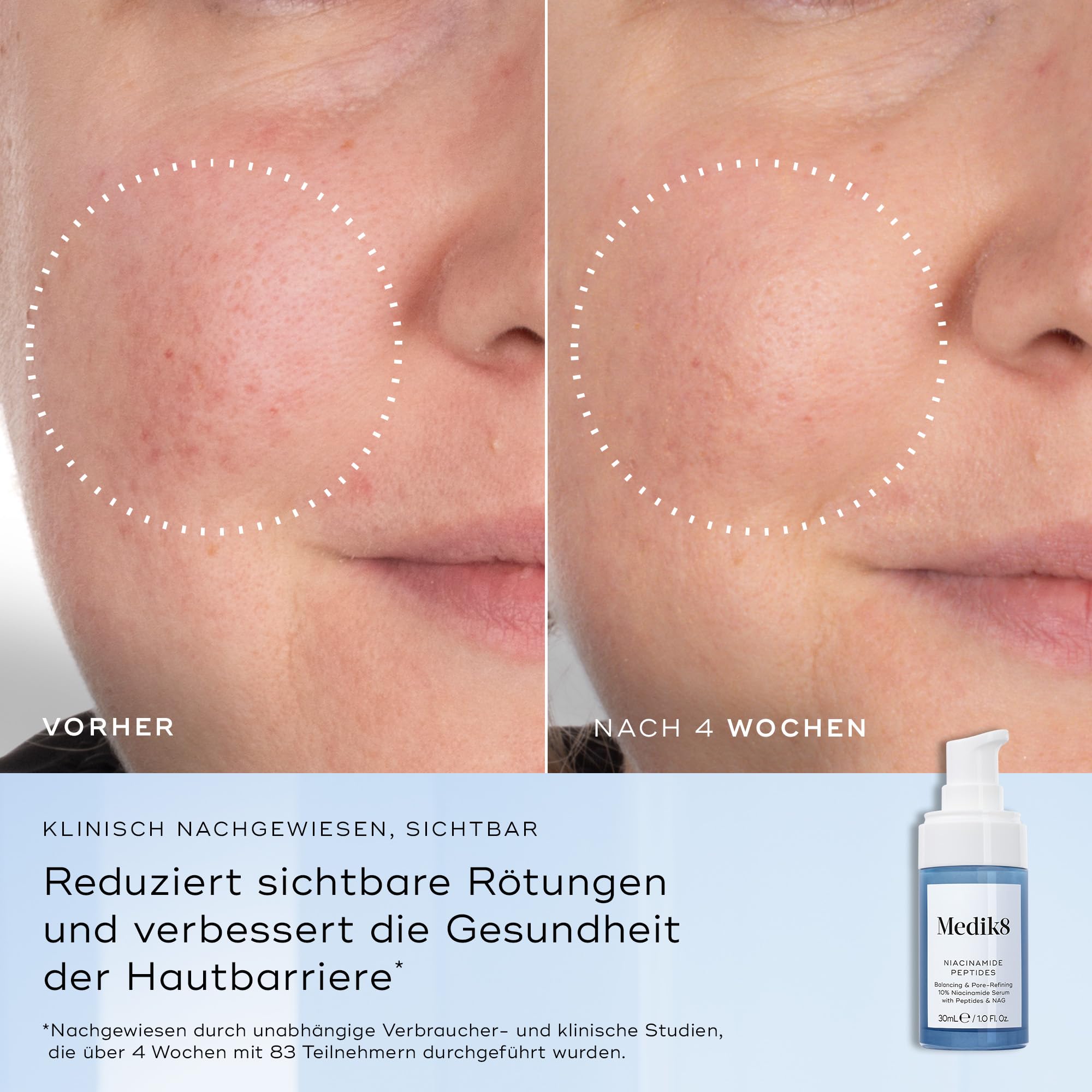 Medik8 Niacinamide Peptides, Verfeinerndes 10% Niacinamid-Serum - 30 ml | Ausgleichend & porenverfeinernd mit Peptiden & NAG – glatterer Teint und Hauttextur, für die Hautbarriere, gegen Unreinheiten