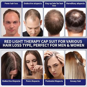 Laser Hair Growth Helmet,236 Pcs Red & Blue Light Laser Stimulates Hair Follicle Growth,FDA Cleared Hair Growth Cap Treatments Restore Hair Thickness,Alopecia for Men & Wom