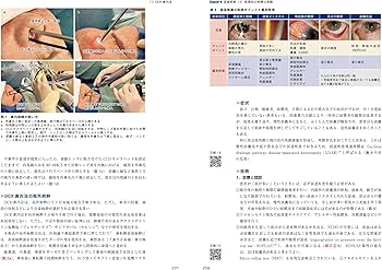 最新 ドライアイと涙道疾患ナビゲートー「涙」の問題はこの1冊で解決