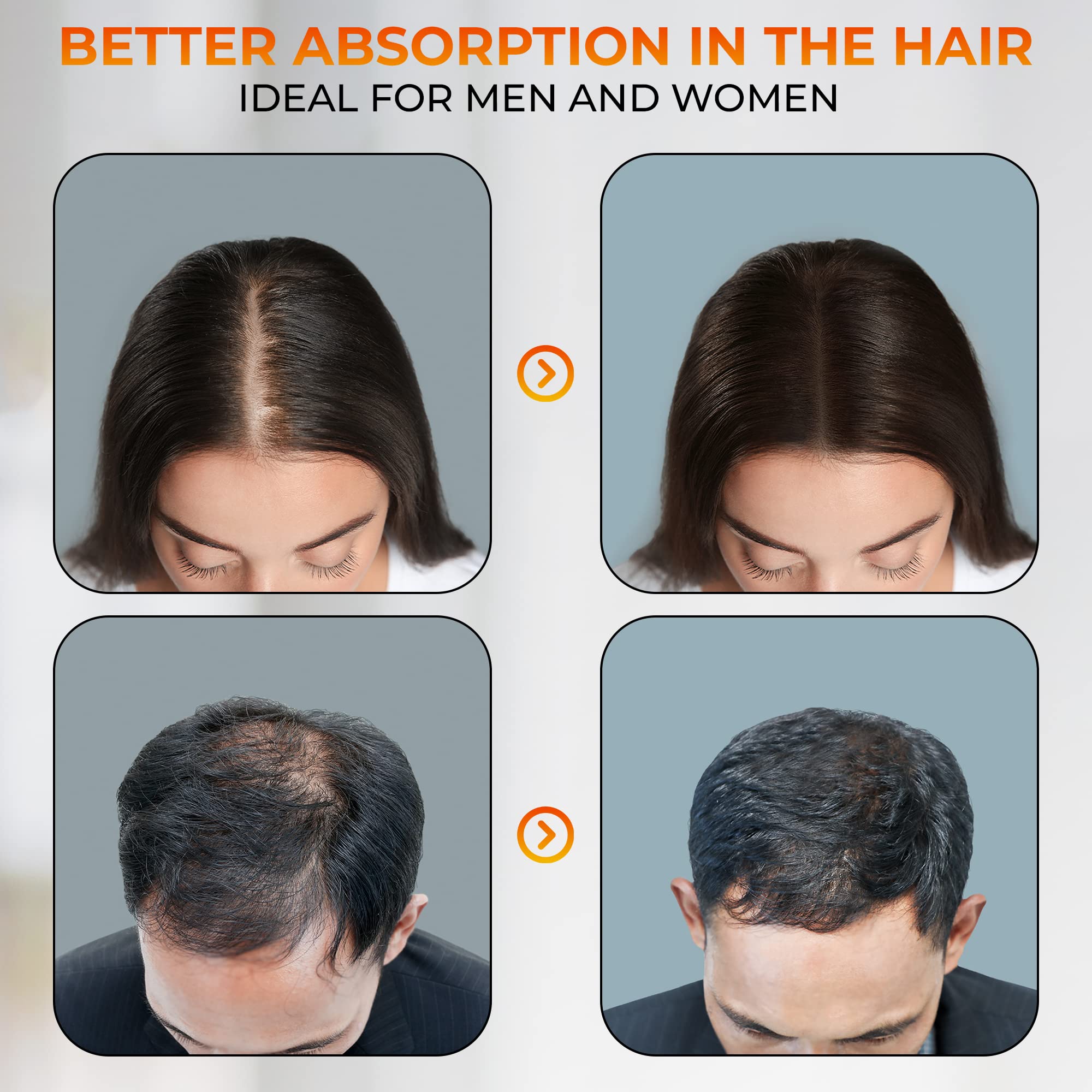 Vitaminas para el cabello, crecimiento de cabello fuerte y sano. Cápsulas crecimiento cabello. HAIR ENERGY, nuevo complejo vitamínico generador energía capilar. 60 cápsulas. Post trasplante capilar.