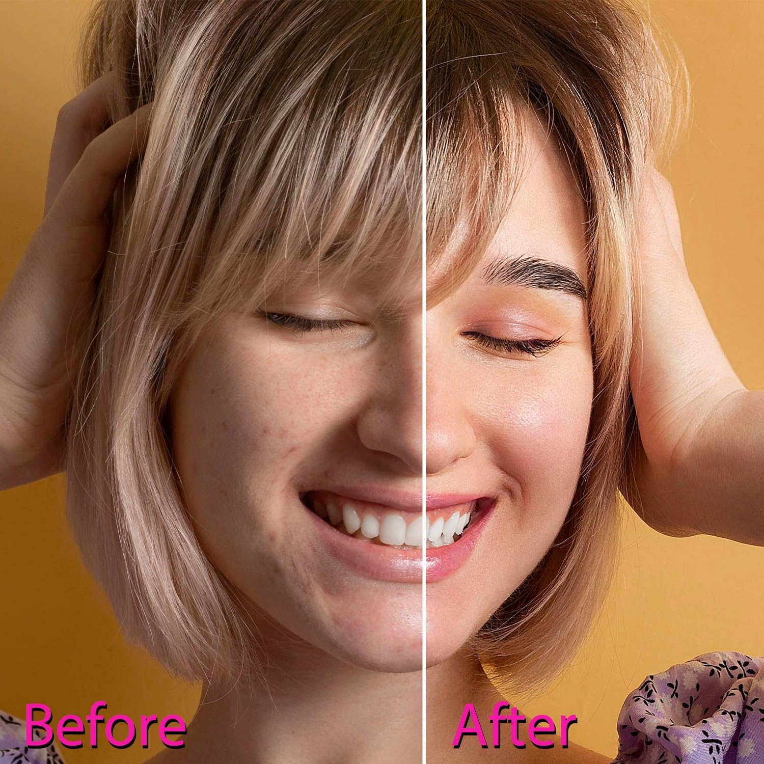 OxyGlow2 Cordless Facial Machine - ProFacial Wand Clinical Skin Therapy Wand - Neon+Argon Gas (Onyx Black) - Image 8