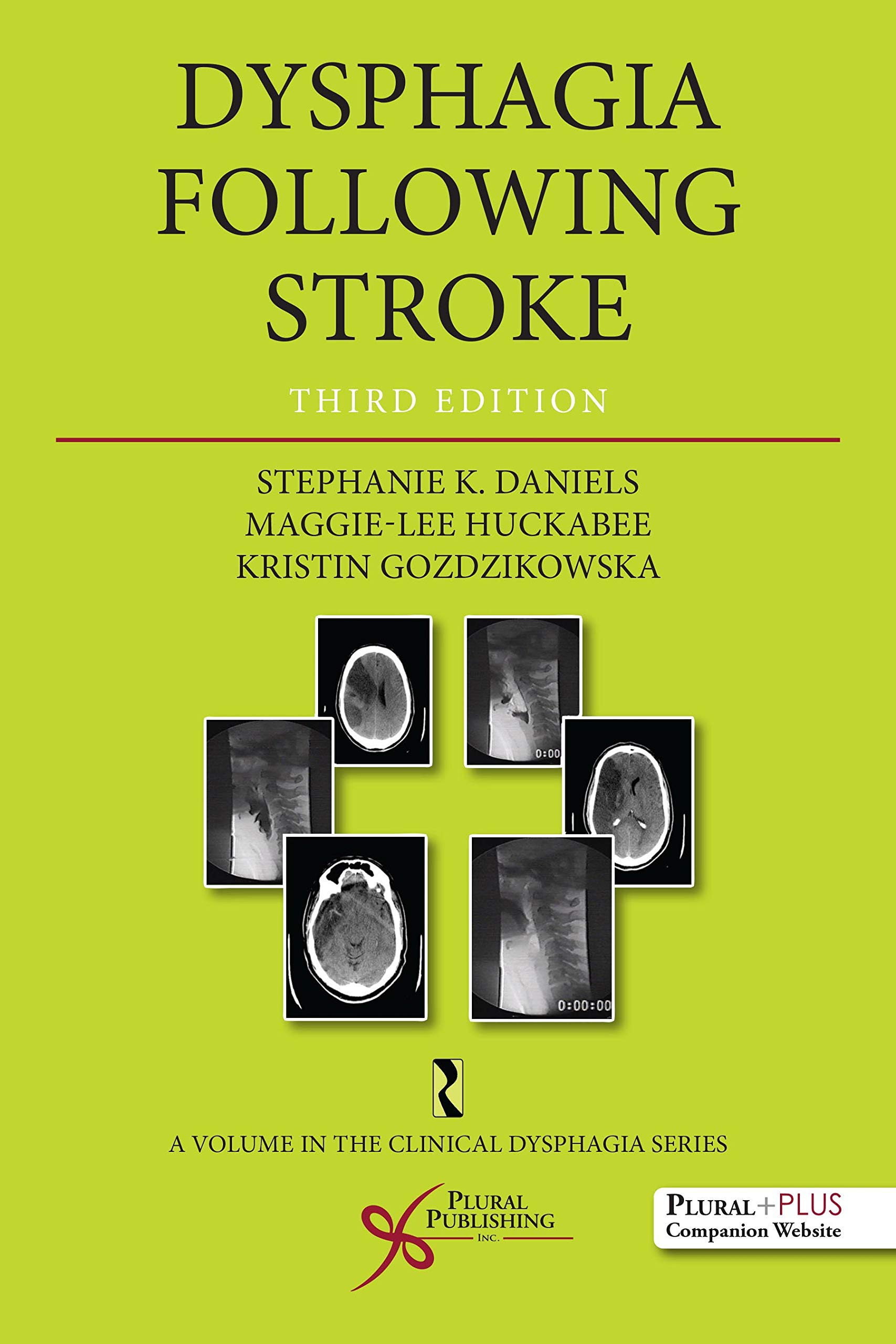 Dysphagia Following Stroke (Clinical Dysphagia)
