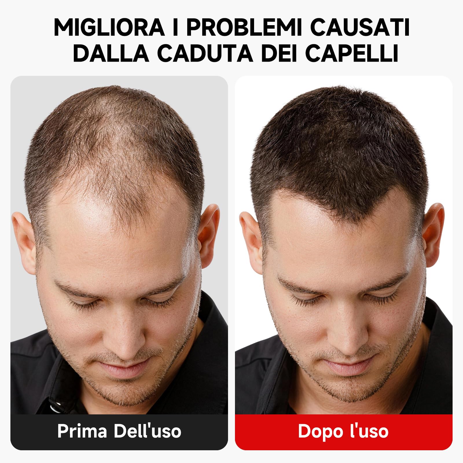 Cappellino Ricrescita Capelli, Cappellino per La Ricrescita Dei Capelli 7 Modalità, 660 nm 850 nm Riduce L'Untuosità E La Caduta Dei Capelli, Migliora La Salute Del Follicolo per Uomo e Donna