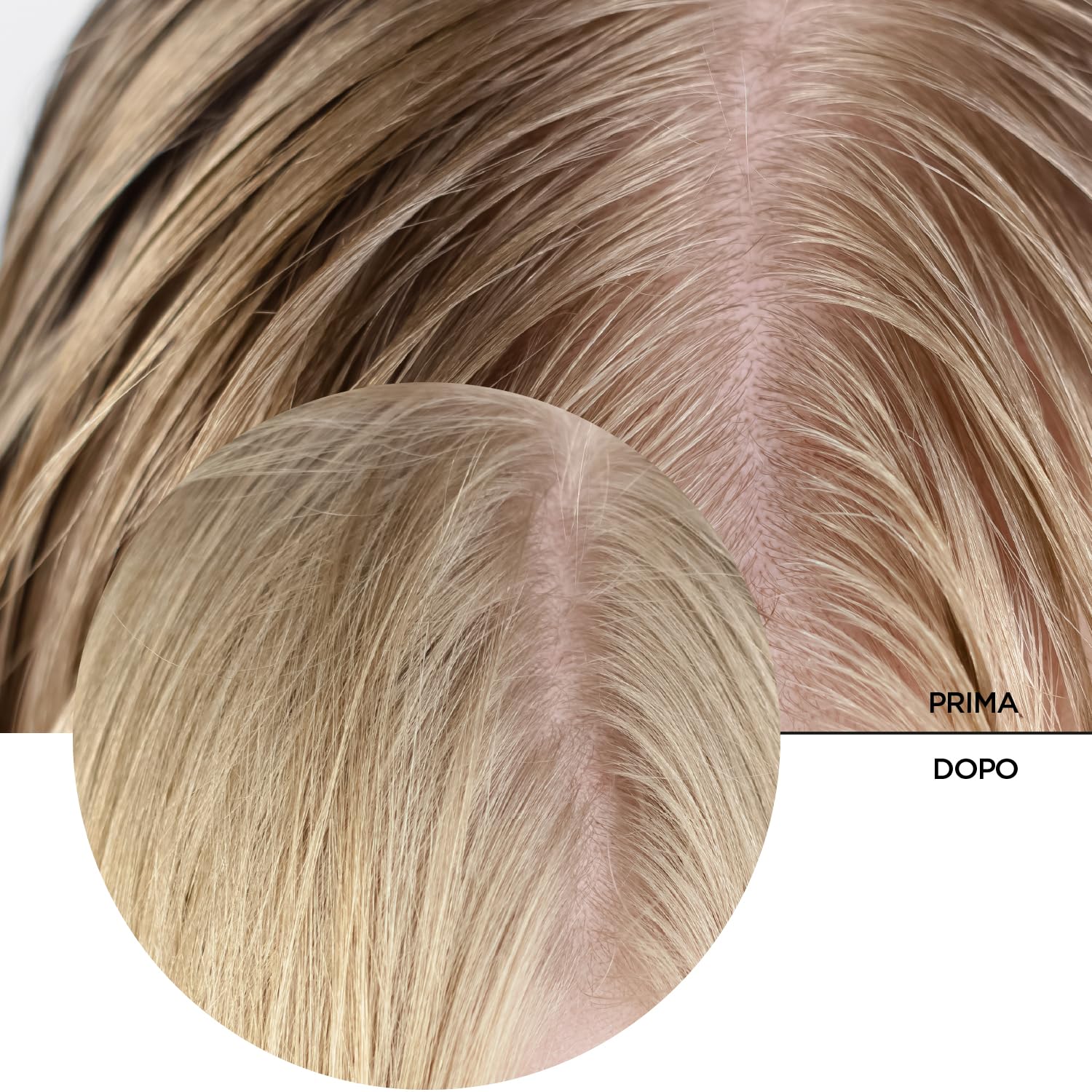 REVOX B77 - Just Acido Salicilico 2% per Cuoio Capelluto, 30 ml, Siero Acido Salicilico, Esfolia e Purifica, Controlla Eccesso Sebo, Idrata e Lenisce Cuoio Capelluto Irritato, Crescita Sana Capelli