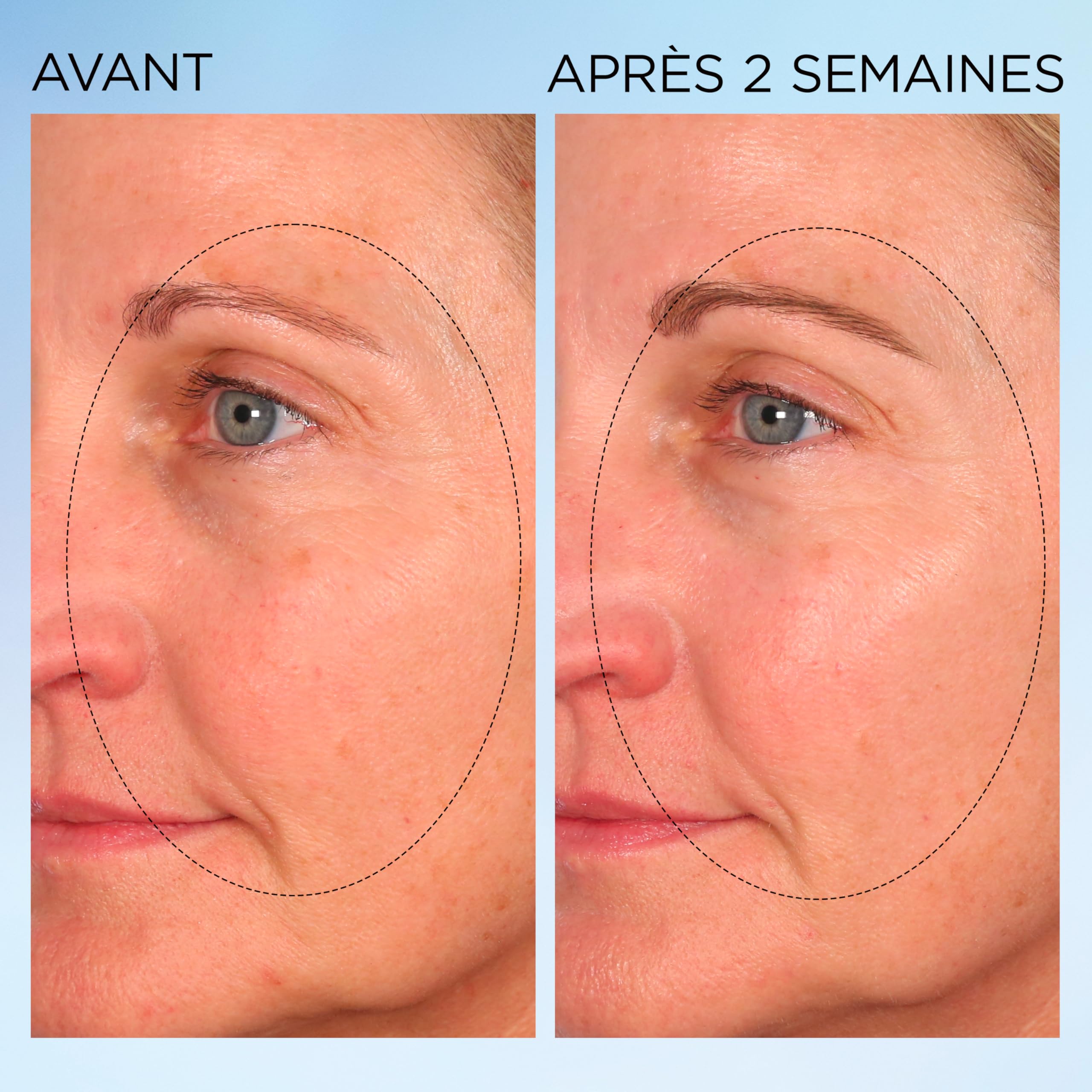 Elizabeth Arden, Visible Brightening Capsules Sérum Correctrices Anti-taches Booster d’Éclat, Serum visage, Soin skincare anti taches brunes, Lisse le teint, Eclat