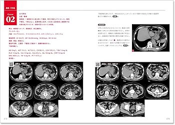 【裁断済】救急画像診断書籍 3冊セット 裁断済】救急画像診断書籍 3冊セット 裁断済】救急画像診断書籍 3