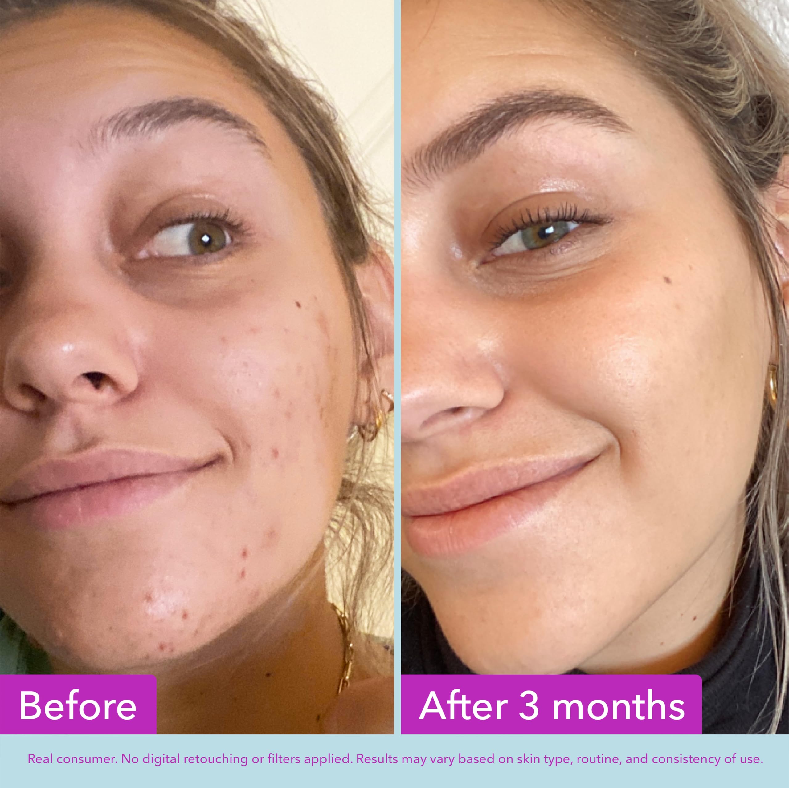 Good Molecules Niacinamide Brightening Toner - Toner for Face with Niacinamide and Arbutin for Skin Tone Balancing- Pore Minimizer, Facial Skin Care: 4 Fl Oz (Pack of 1)