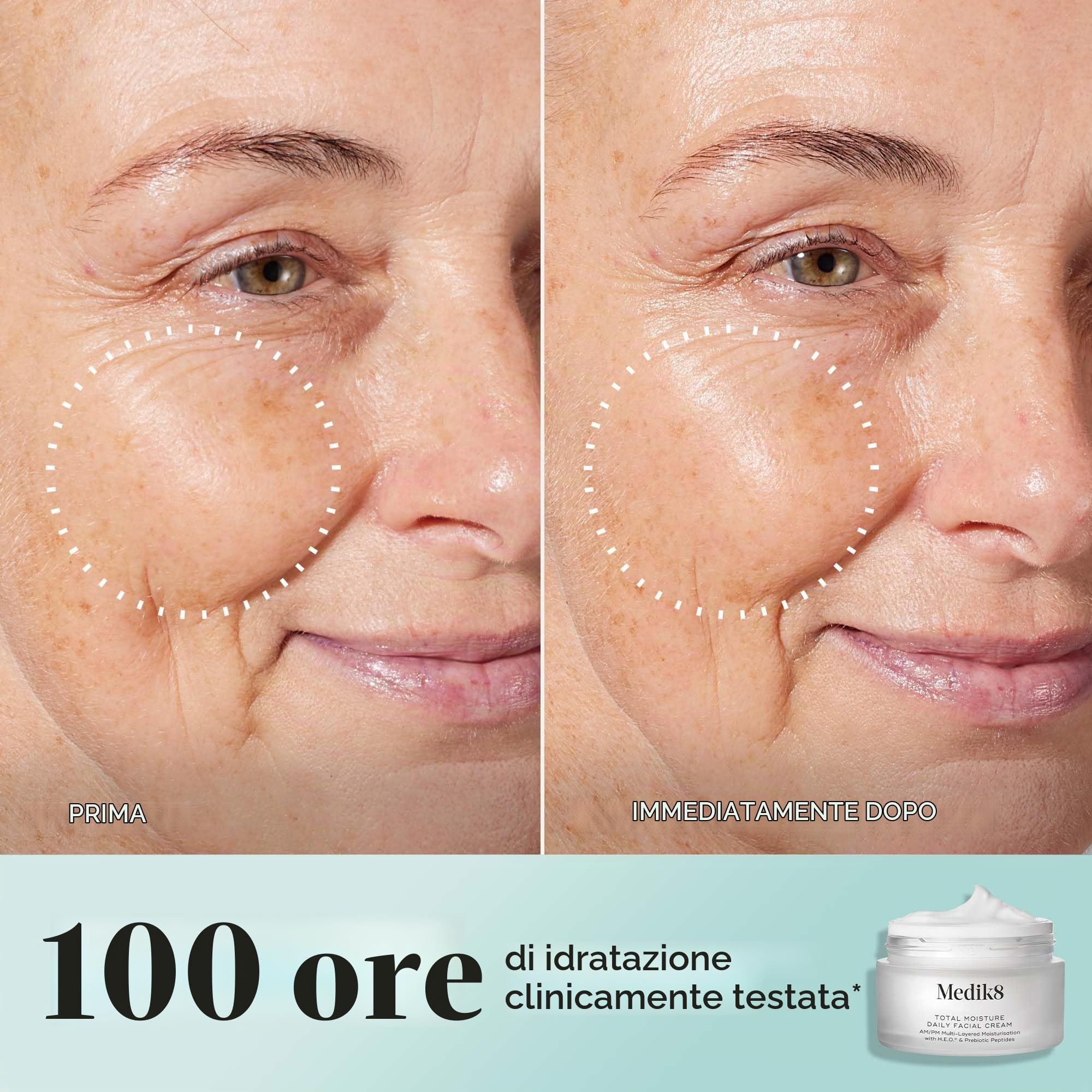 Medik8 Total Moisture Daily Facial Cream™ – Crema idratante all'acido ialuronico, crema viso giorno e notte, Idratazione istantanea, profonda e duratura clinicamente testata, Senza profumo per tutti i