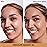IT Cosmetics Bye Bye Dark Spots Concealer + Brightening Serum - 2% Niacinamide, Hyaluronic Acid & Caffeine - Medium Coverage, Natural Finish, All Skin Types - 32 Medium Warm, 0.22 fl. oz