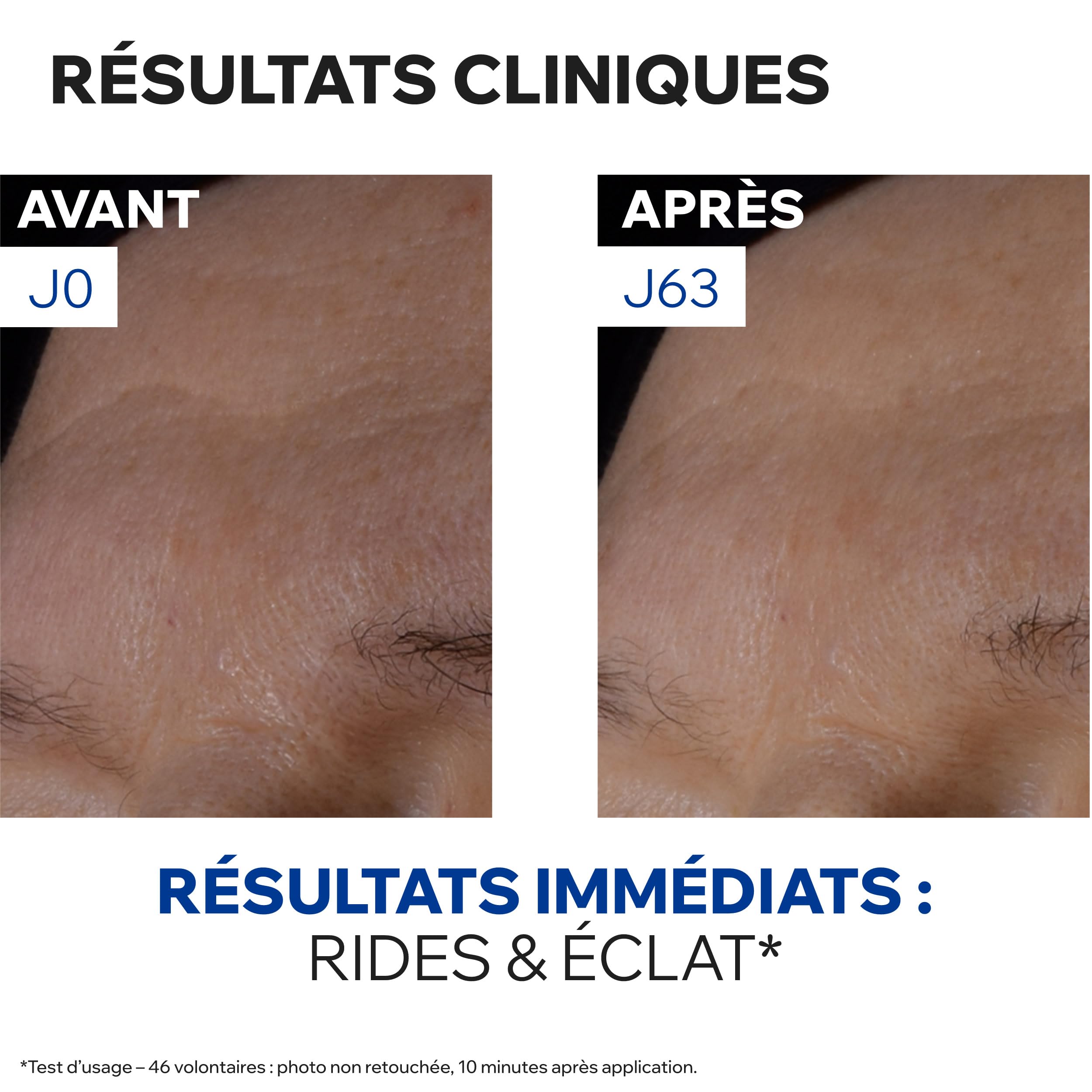 Uriage Age Absolu Masque de Nuit Raffermissant - Rétinol, Acide Hyaluronique, Beurre de Karité - Booster de Procollagène x6 - Rides, Relâchement - Volume & Hydratation - Brevet Anti-âge Exclusif -50ml