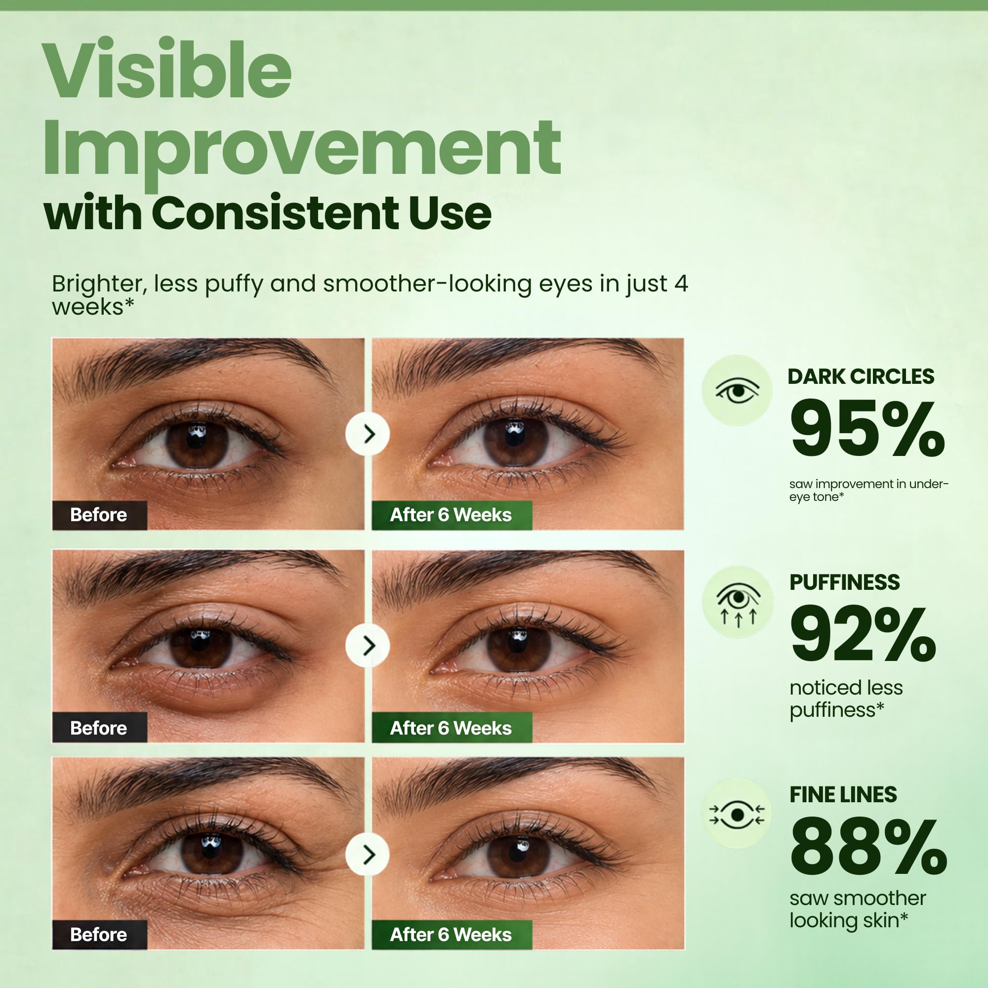Eyecirque EyeLift Under Eye Cream for Dark Circles, Puffiness, Fine Lines & Wrinkles with Alpha Arbutin, Retinol & Niacinamide - Brightening Night Repair Formula for Men & Women - 20g — Amazon image 4