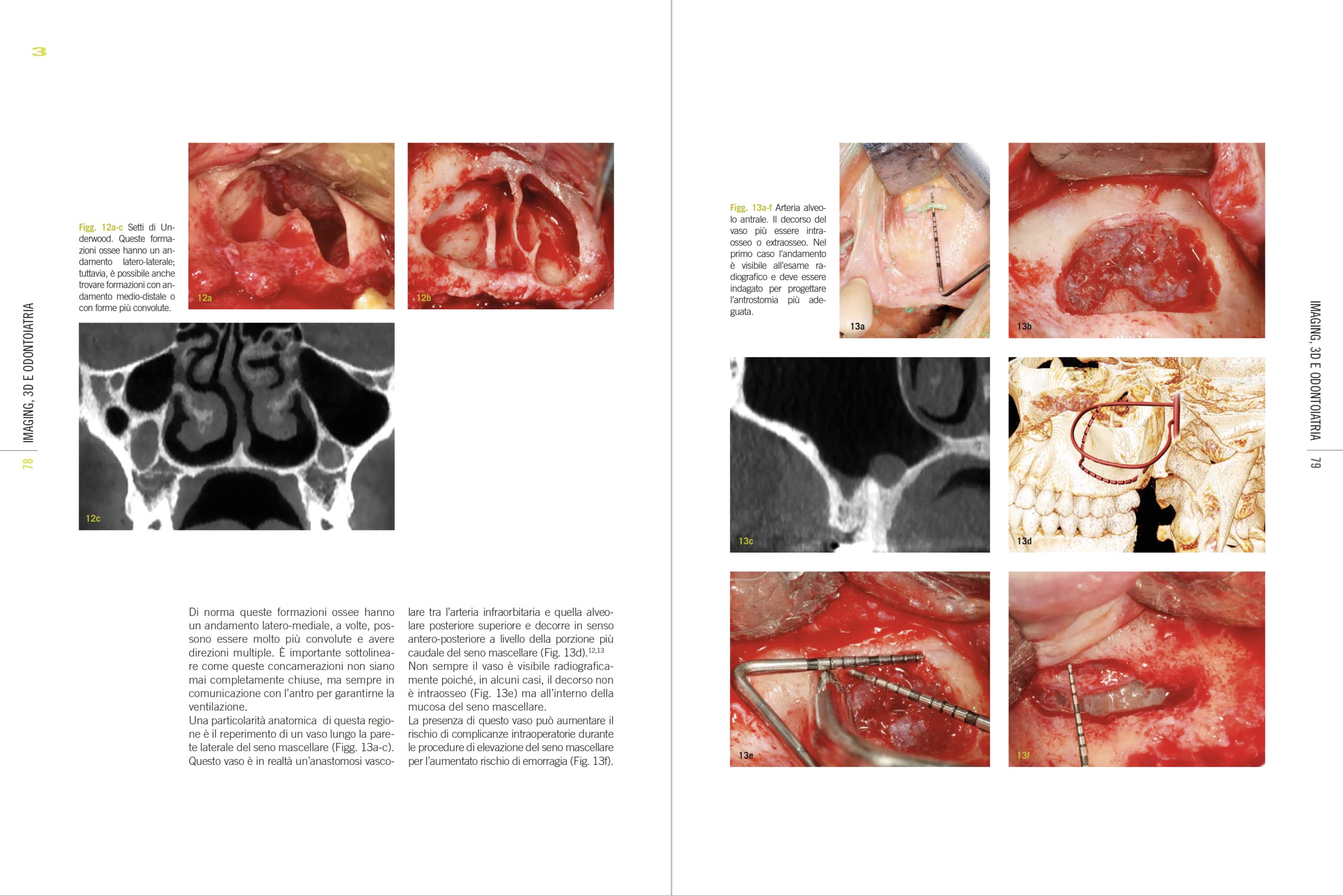 Imaging, 3D e odontoiatria. Dalla cefalometria multiplanare alla navigazione guidata in implantologia