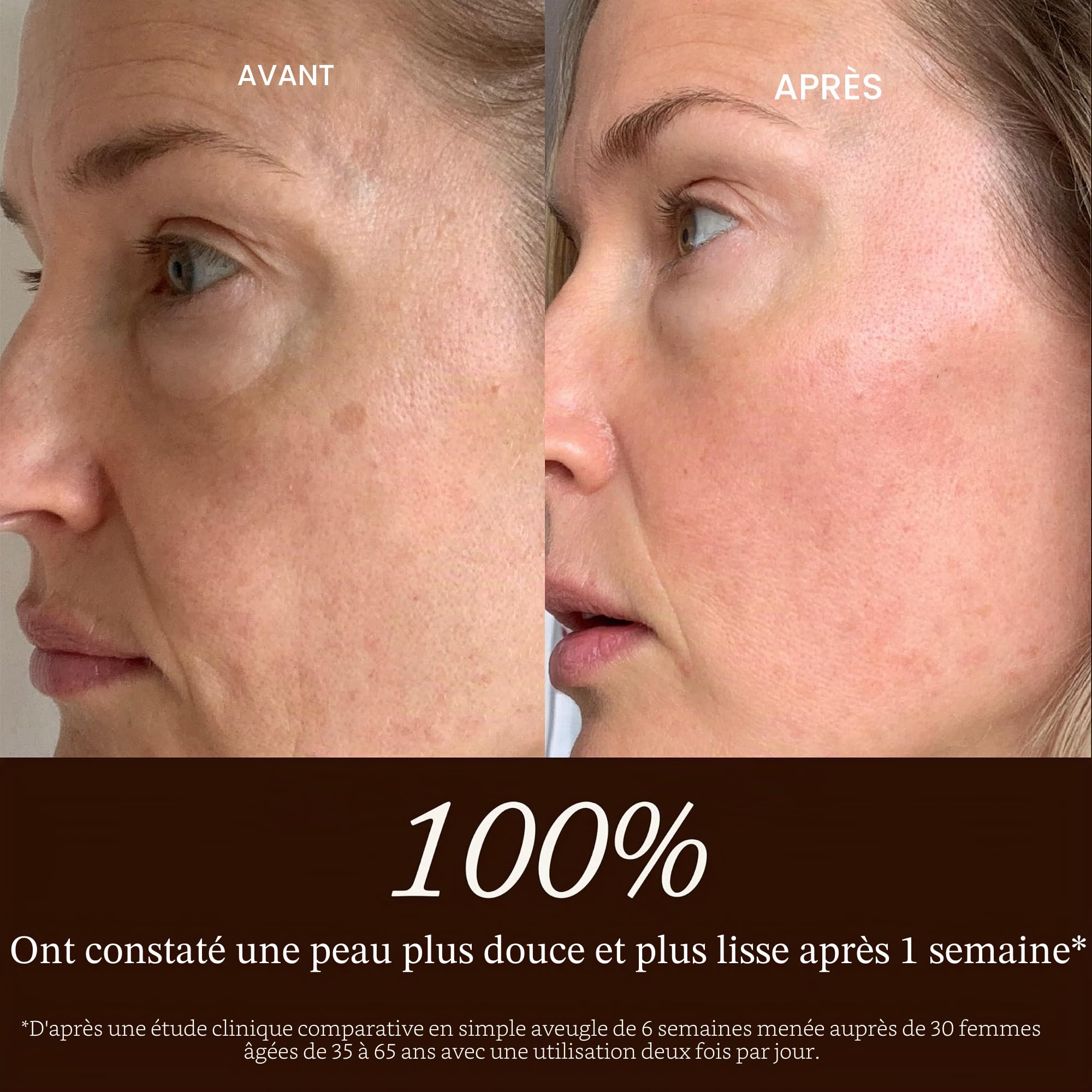 True Botanicals - Sérum naturel Chebula Active | Soin de la peau propre, non toxique et naturel (30 ml)