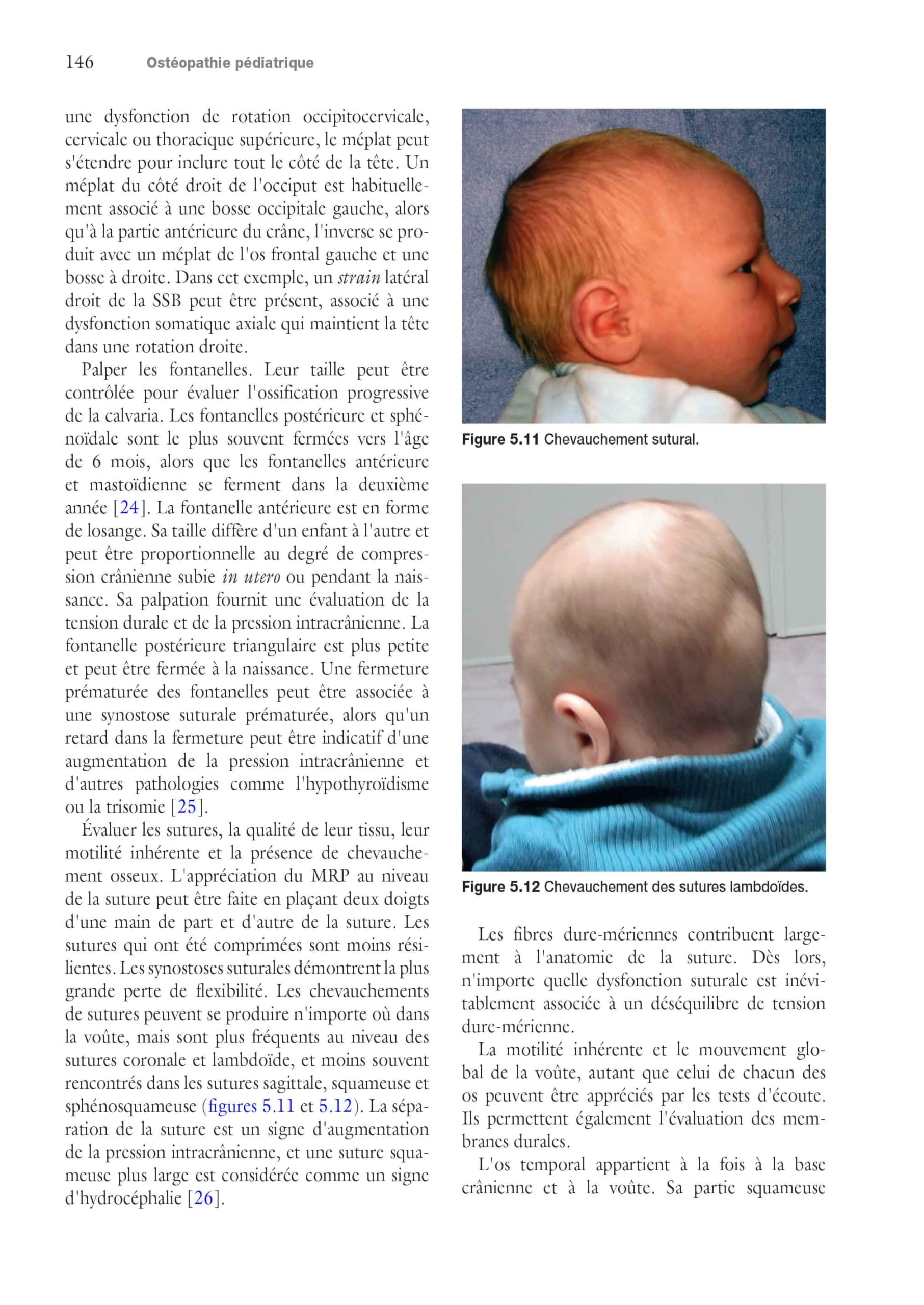 Ostéopathie pédiatrique