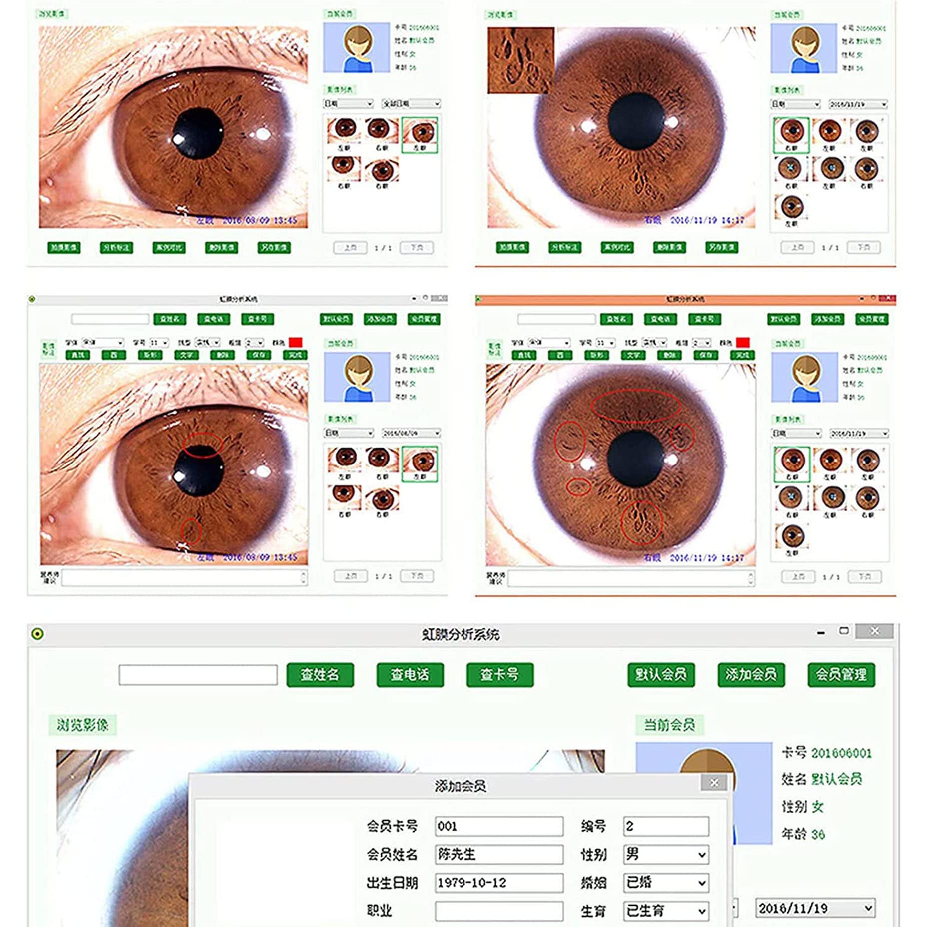 Iris-Analyse-Kamera, 5,0 Mp USB-Iris-Analysator-Iridologie-Kamera Mit 30-Fachem HD-Iris-Objektiv, Iris-Lupe, Augen-Iris-Kamera Für Schönheitssalons, Gesundheitsmanagement-Zentren