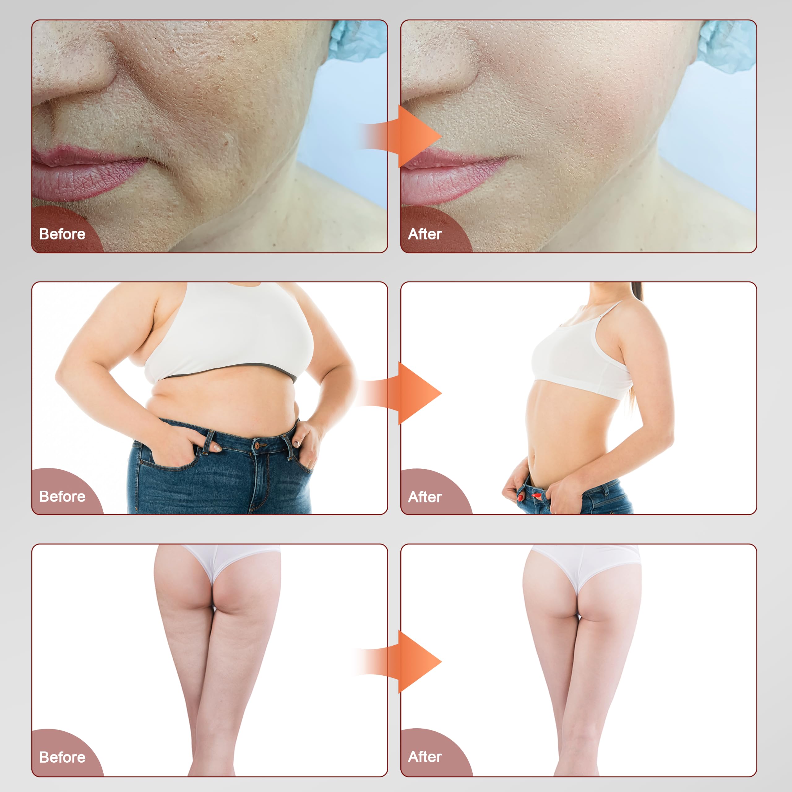 Elitzia 5 in 1 Body Sculpting Machine Skin Tightening for Home & Salon Use with 40K Cavitation, RF, Vacuum RF, Lipo Laser Pads Multifunctional Beauty Device Fullbody Contouring ETLW202T