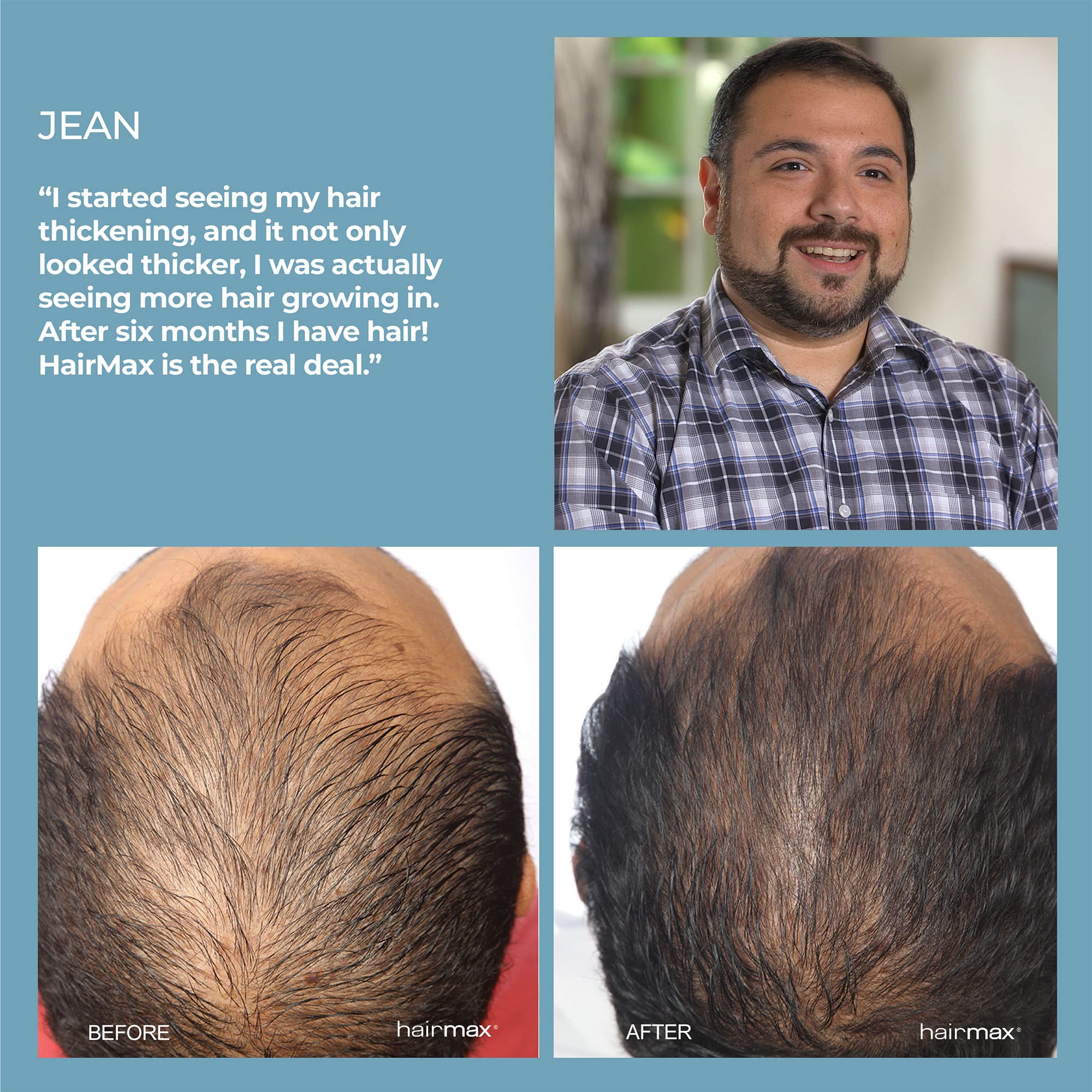 HairMax Laser Hair Growth Comb Ultima 9 Classic (FDA Cleared), Hair