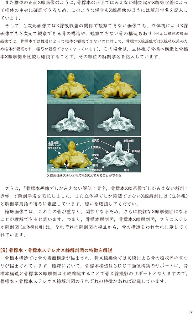 ステレオ視でみる 骨標本・X線＆血管立体解剖図―理解アップのための