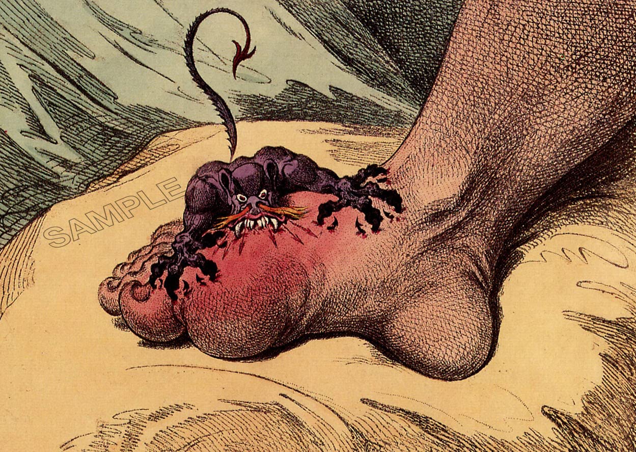 The Gout By James Gillray Vintage Poster Painting Photo Wall Art Picture Poster A4