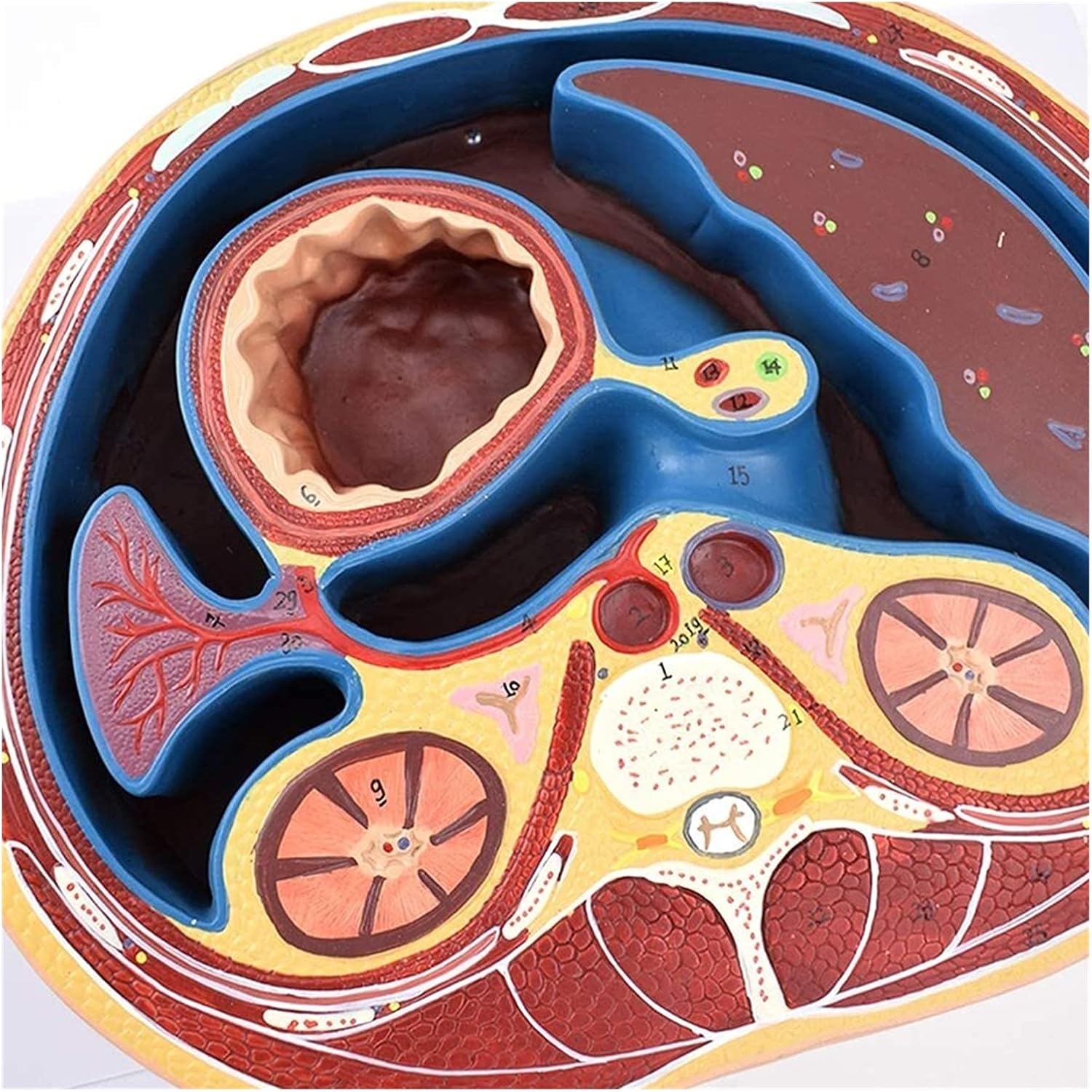 Medical Anatomical Model, Human Anatomy Science Models Human Abdome