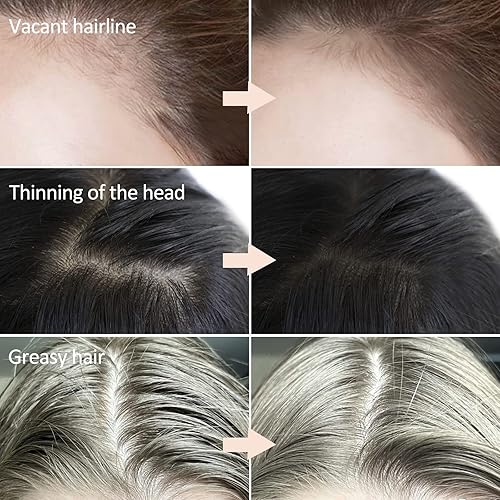 Miniatura 2 de Boobeen Polvo para cabello fino, polvo de retoque de raíz, cubierta de sombra de cabello al instante, polvo de línea capilar para mujeres y hombres